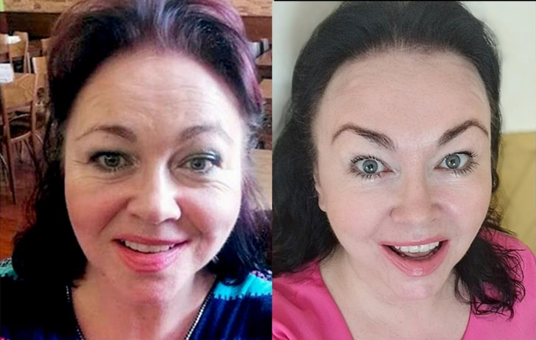 Omlazovna Kateřiny Schlosserové foto 2