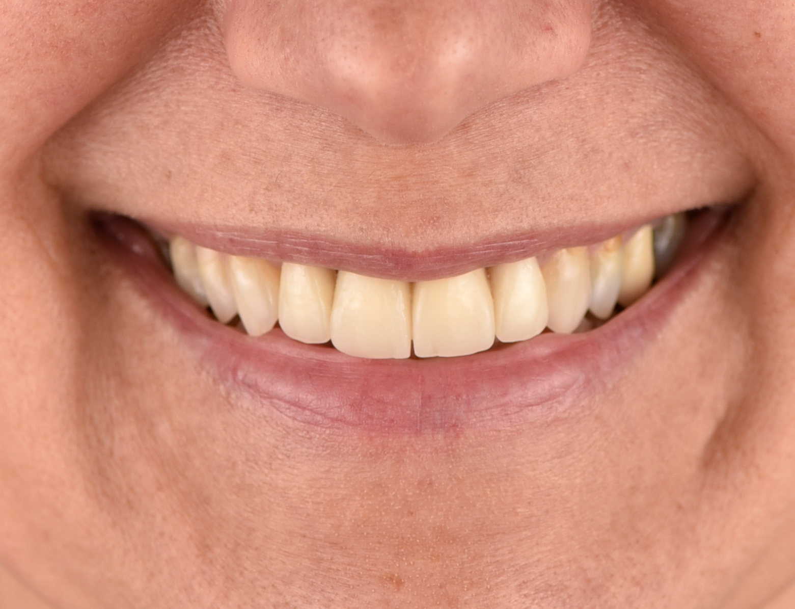PRO DENTiS foto 2