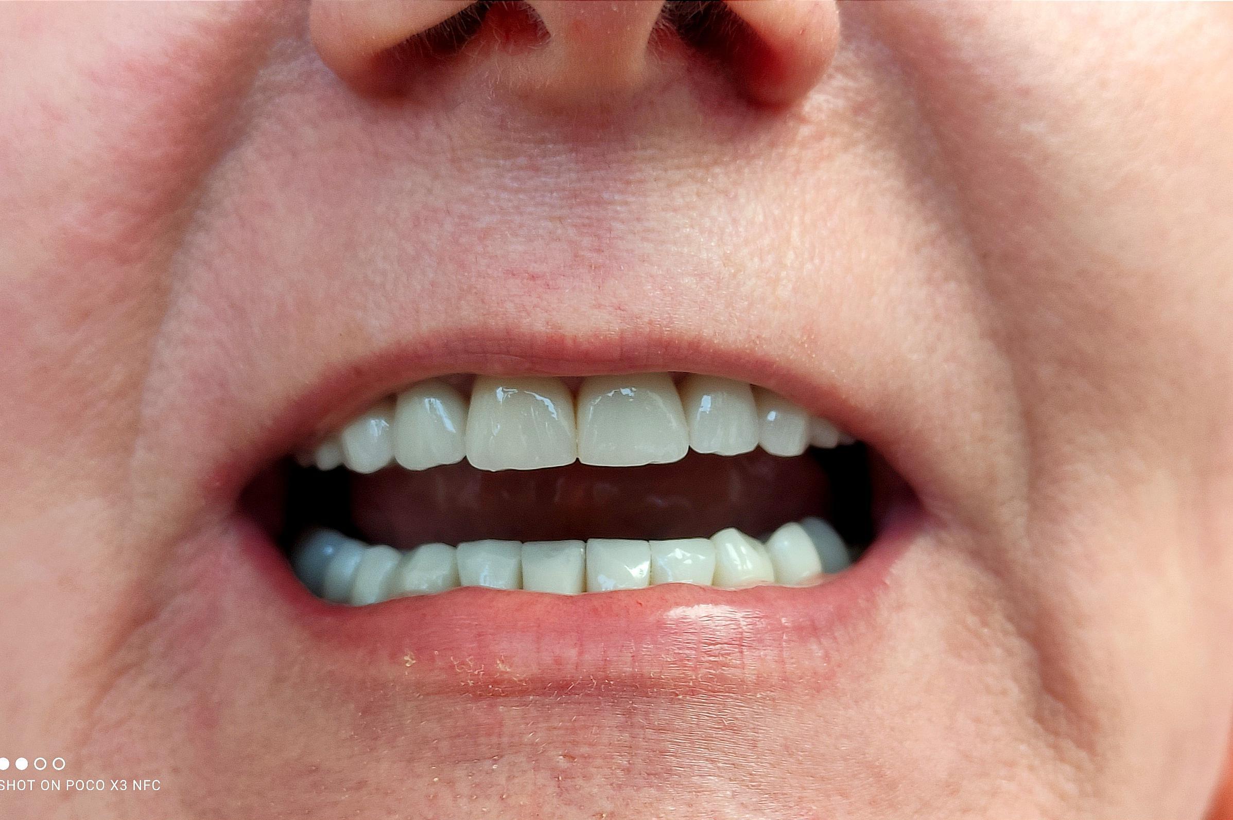 Zubní laboratoř Zuzana Gabrielová