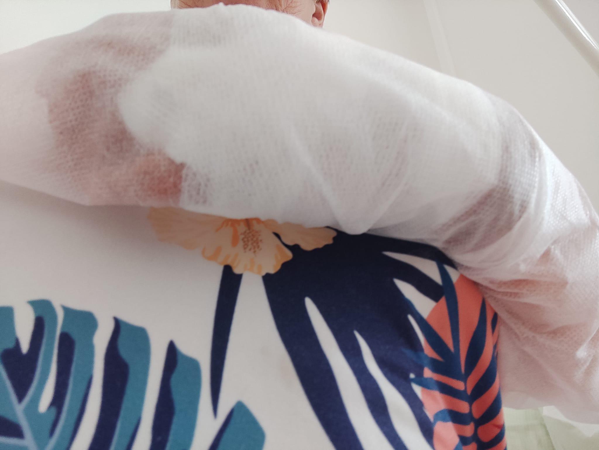 Ústav chirurgie ruky a plastické chirurgie foto 3