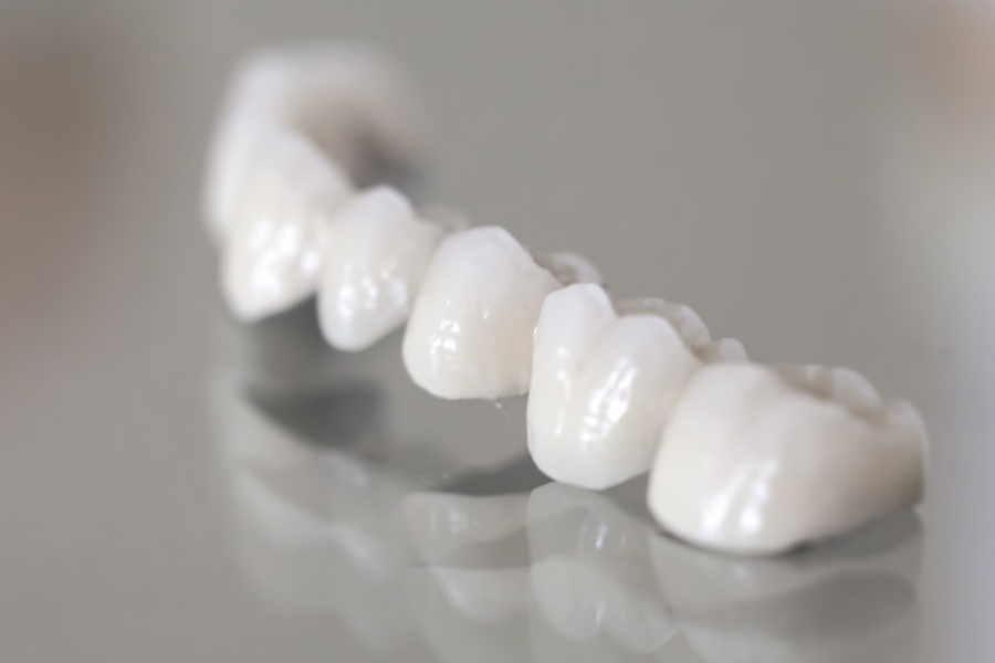 Aplikace zirkonové korunky