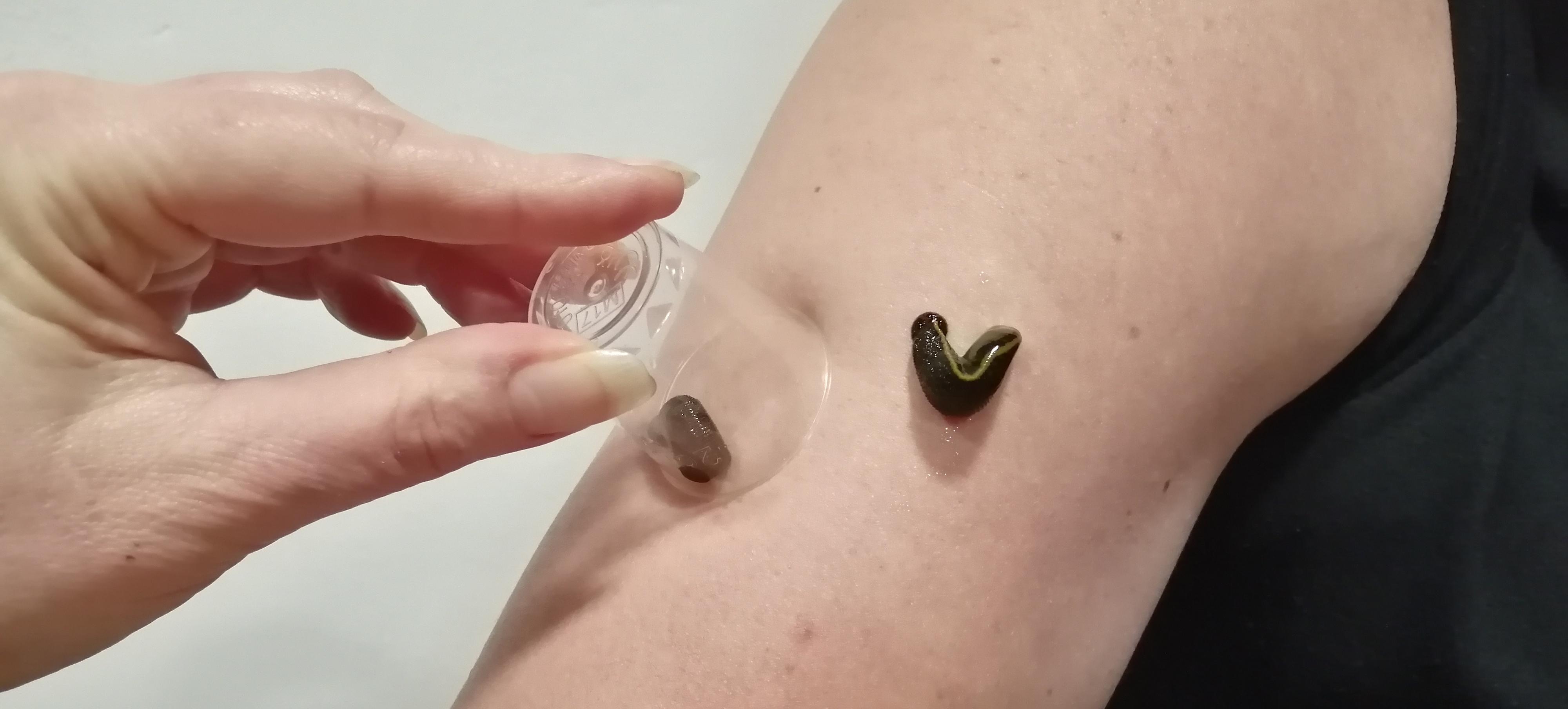 Centrum regenerace a zdraví Perla foto 4