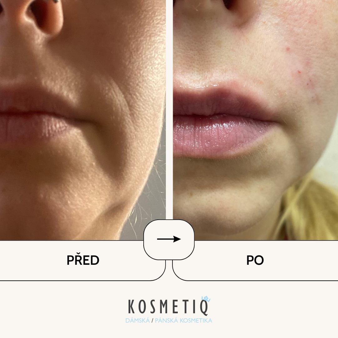 Kosmetiq foto 6