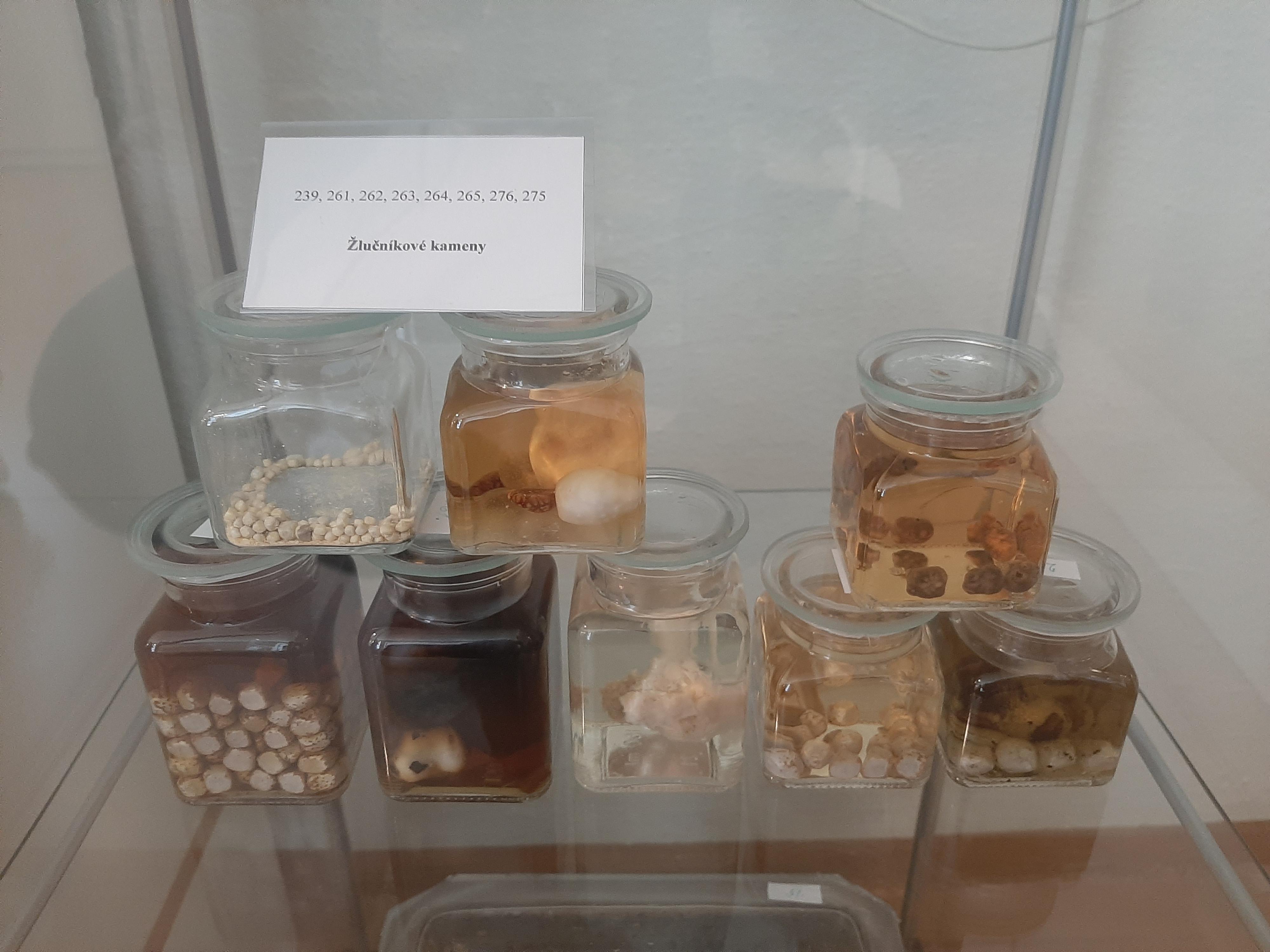 Muzeum patologie - Moravskoslezská nemocnice Opava foto 5