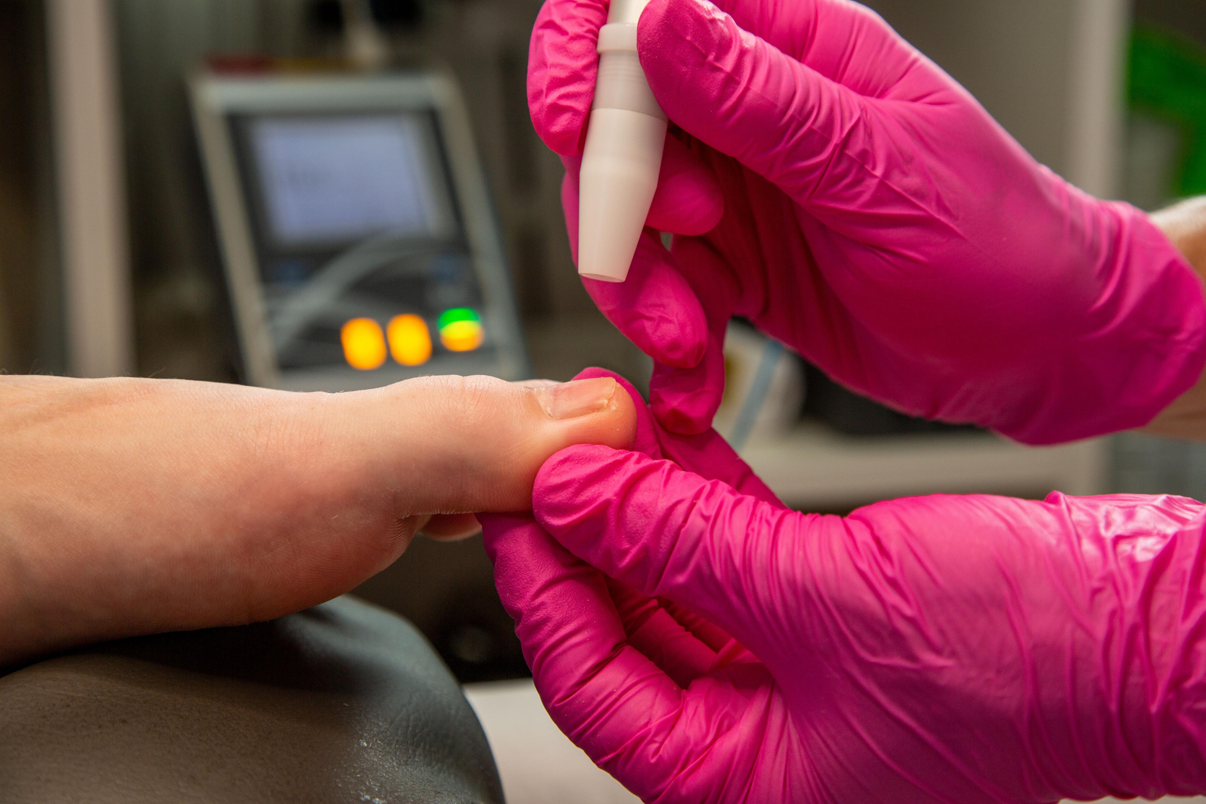 Pedikúra - podologie Olina Procházková foto 4