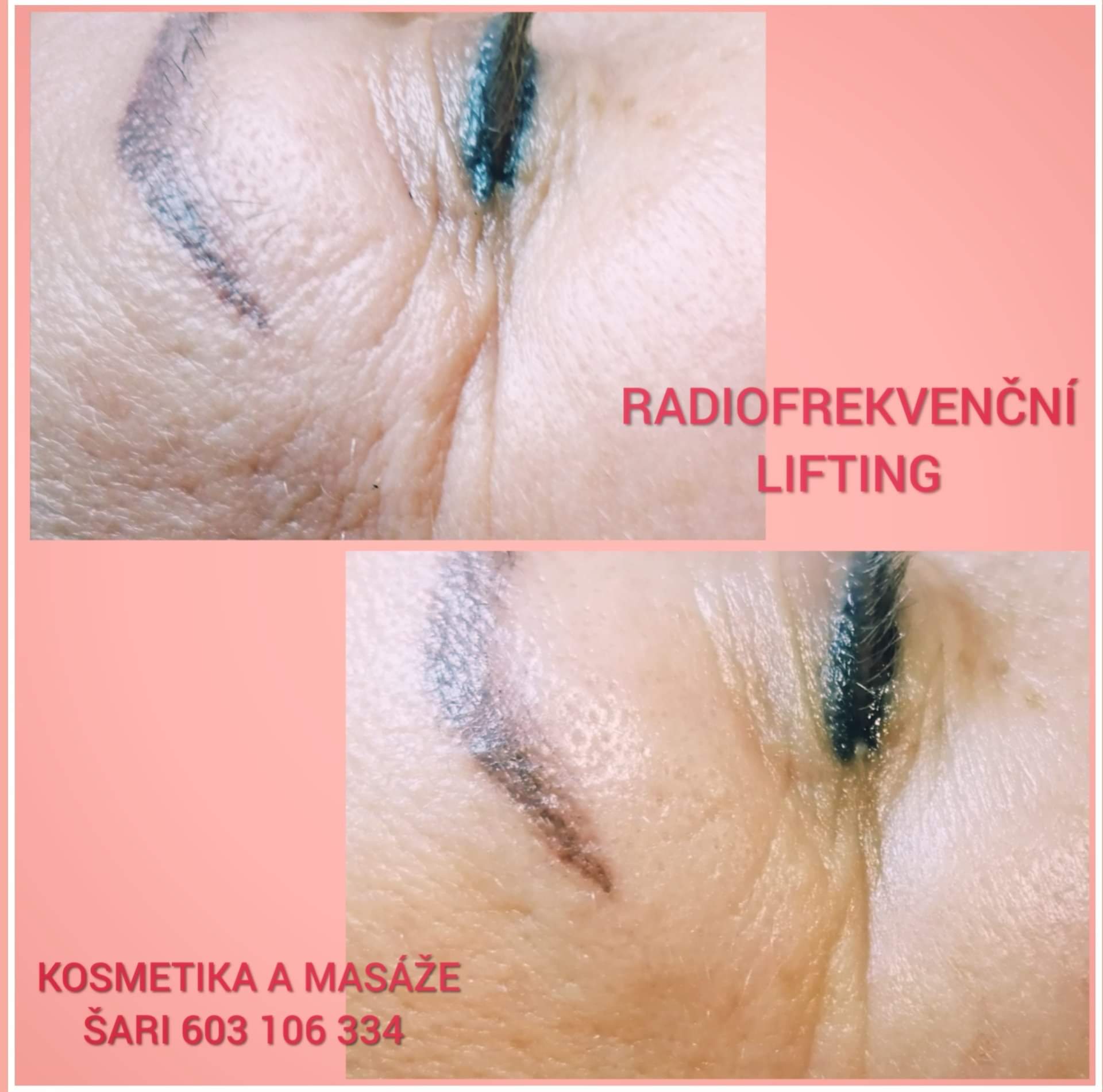 Kosmetika a masáže Šari foto 3