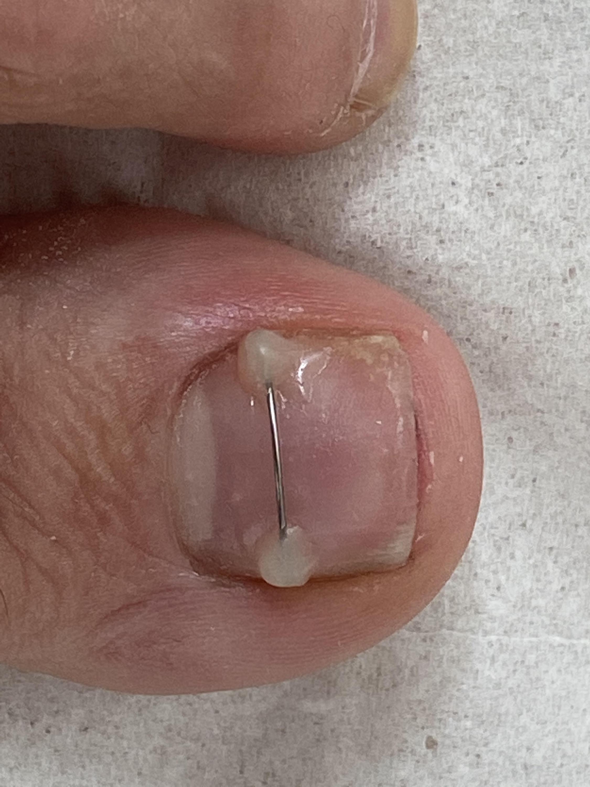 MediPedi Pedikúra Podologie foto 5