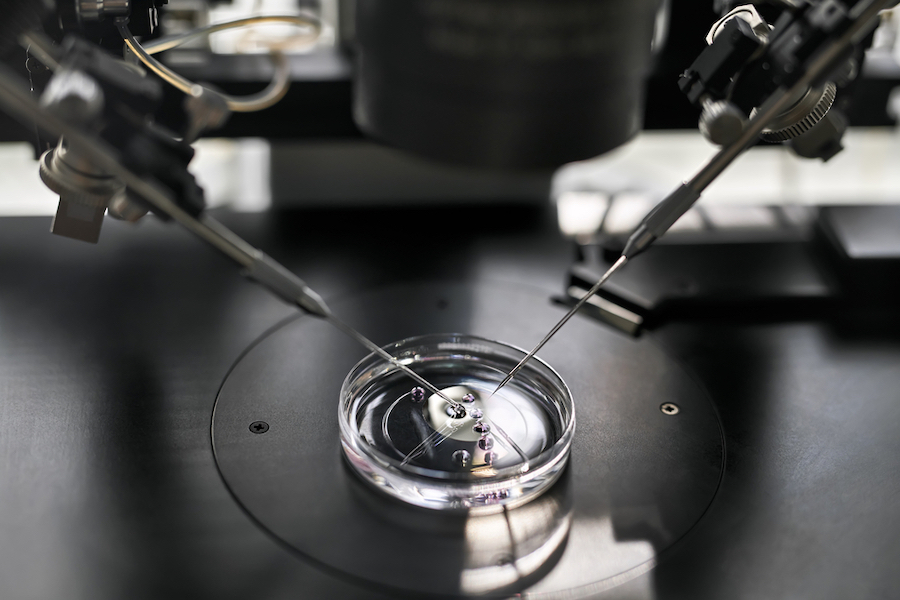 Asistovaná reprodukce - IVF