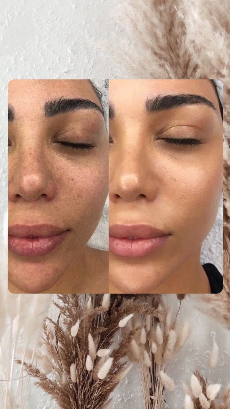 LIN_skintherapist foto 2