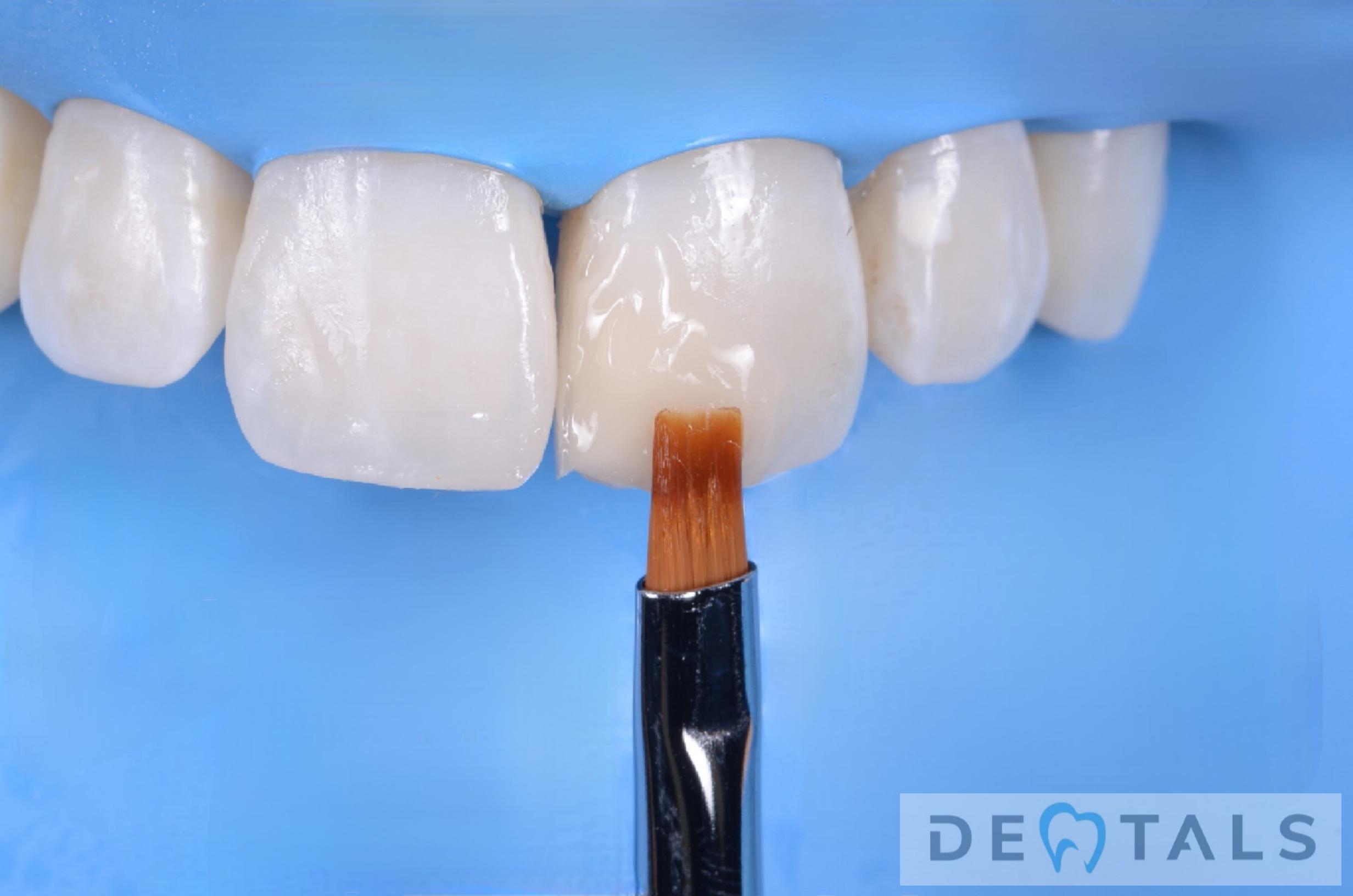 Dentals foto 2
