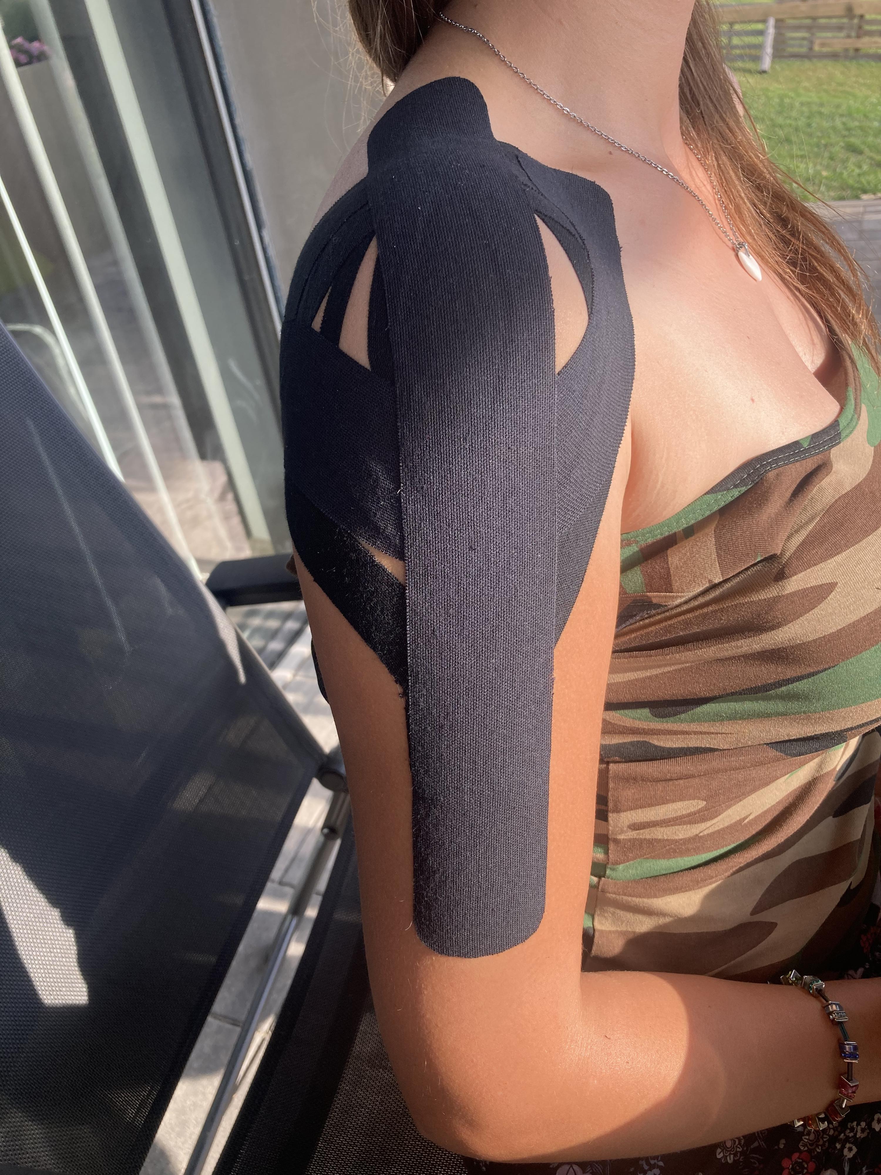 Tejpování - aplikace elastických pásů