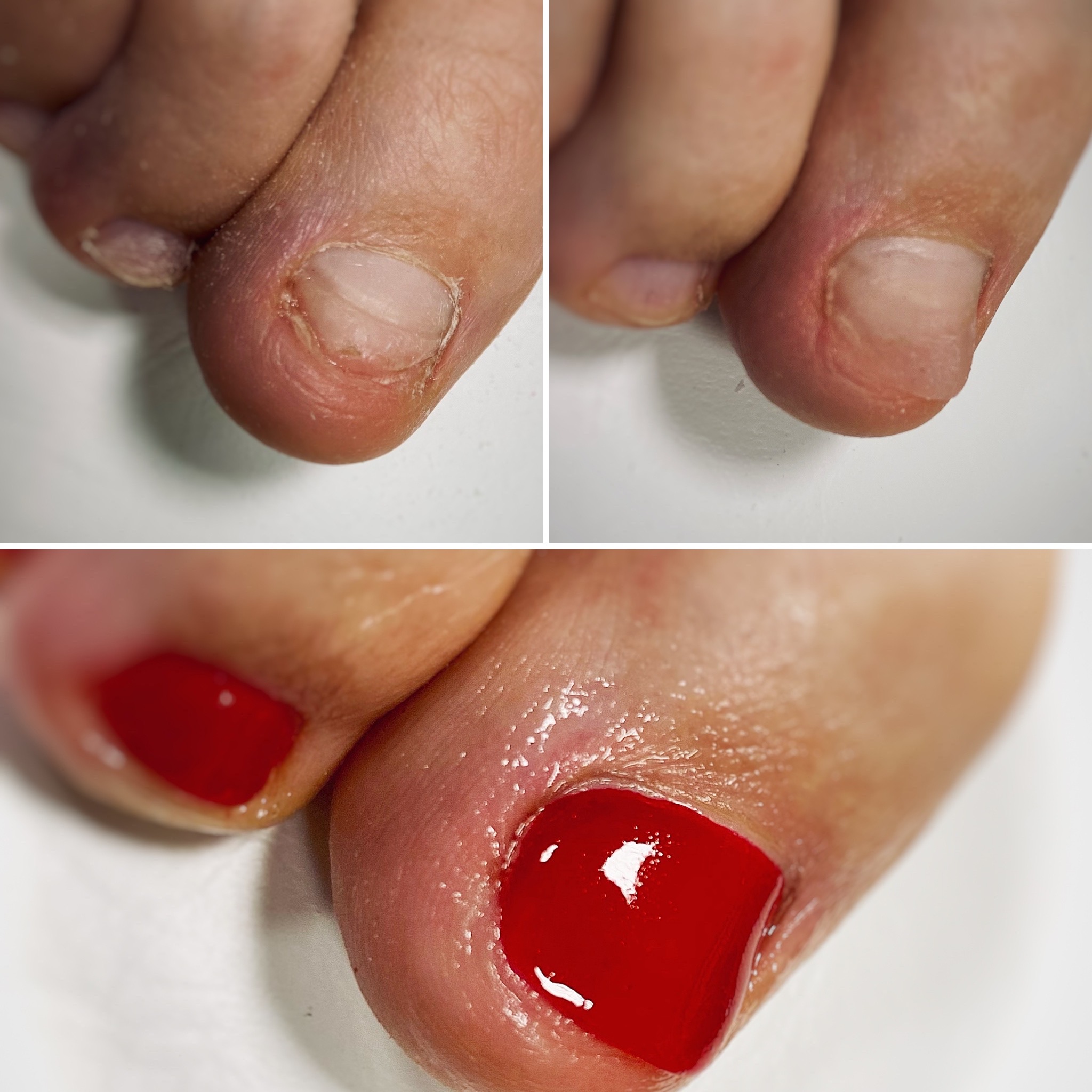 Pedikúra Monika Gožďálová foto 3