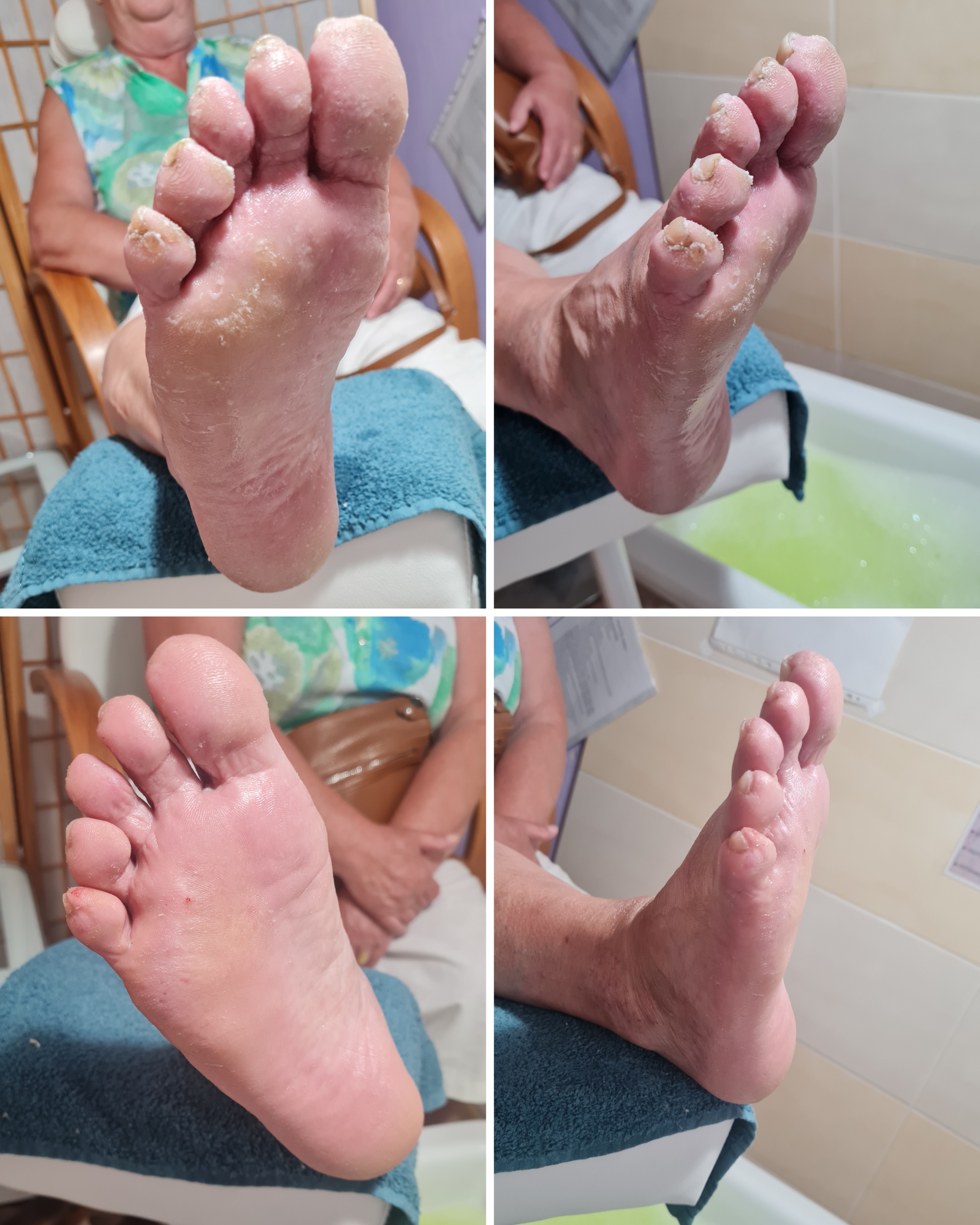 Pedikúra Jana Vašíčková foto 2