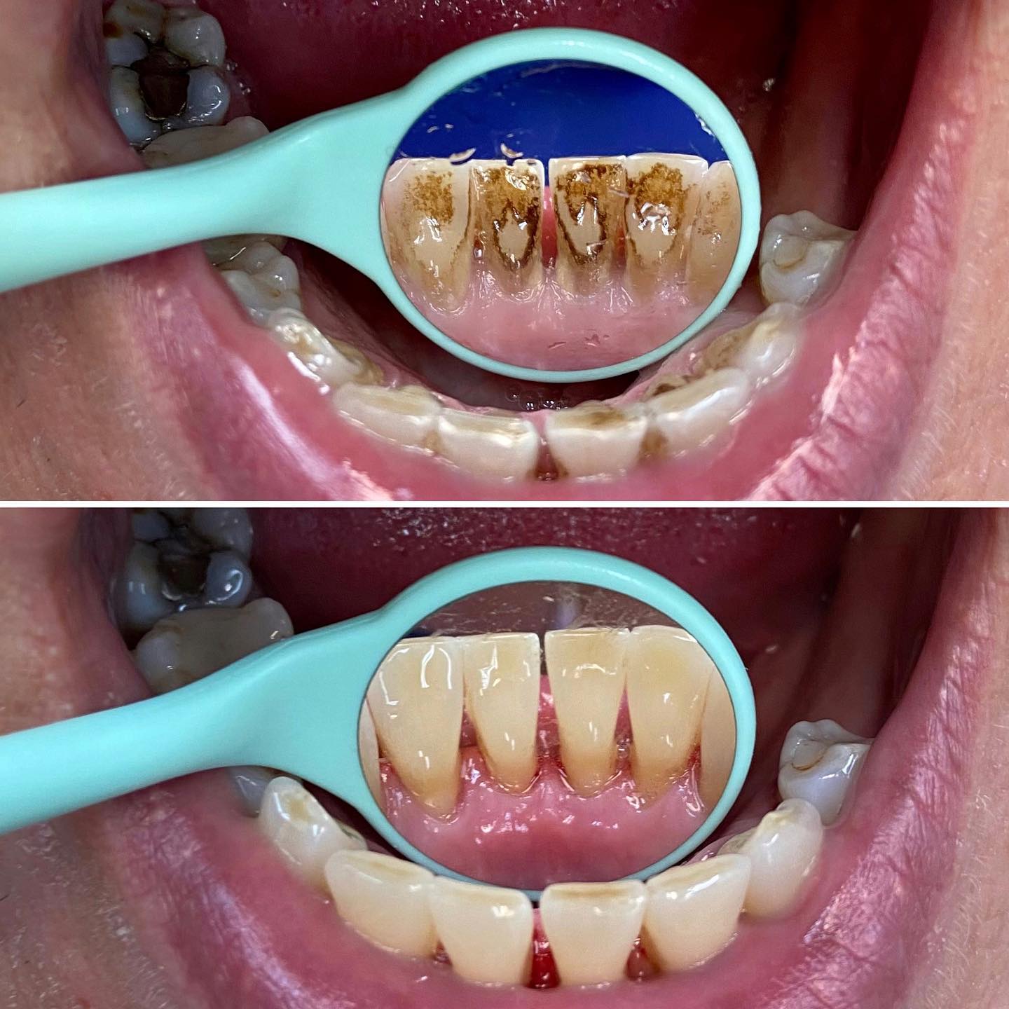 Dentální hygiena Alena Valentová, DiS. foto 3