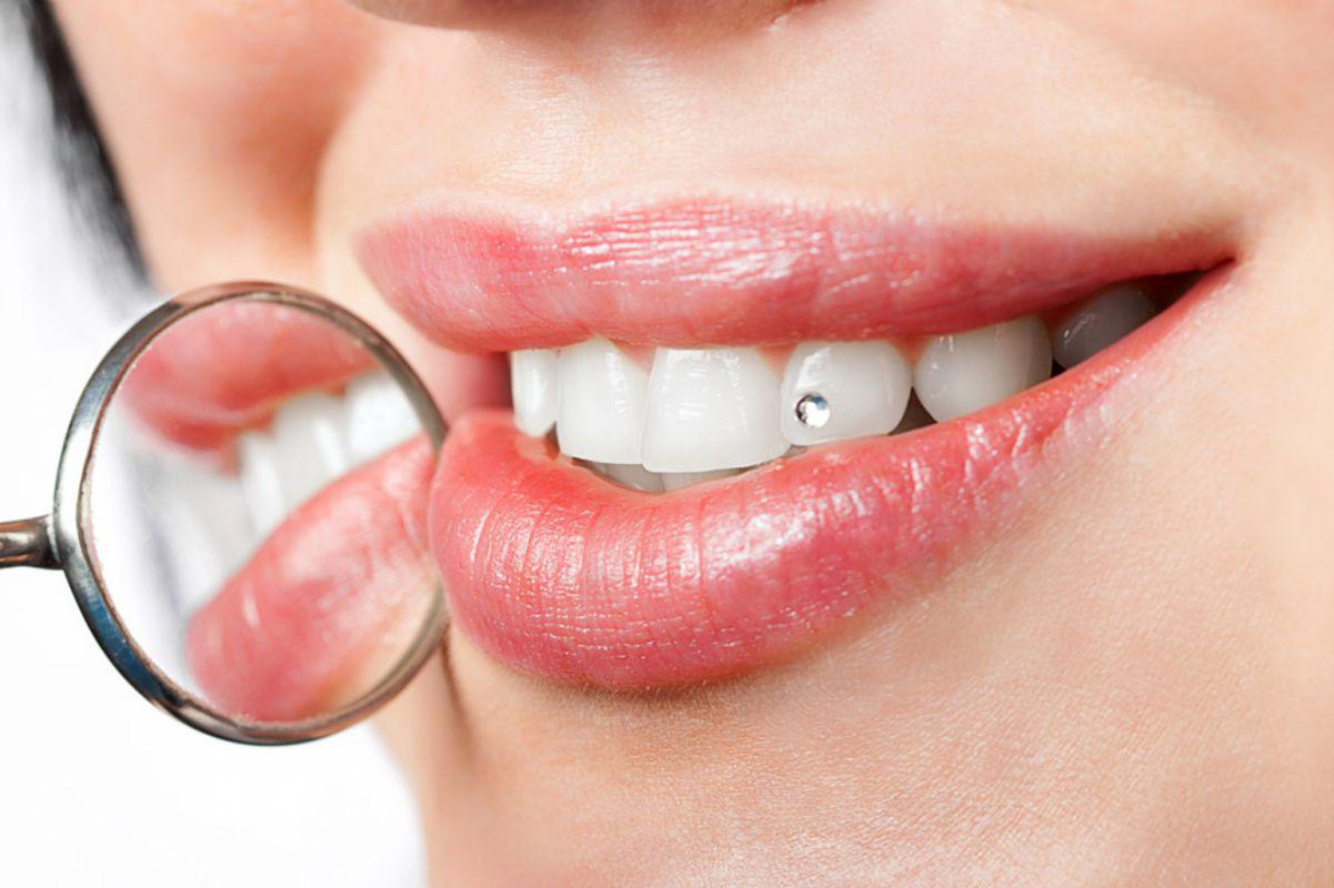 Dentální hygiena Alena Valentová, DiS.