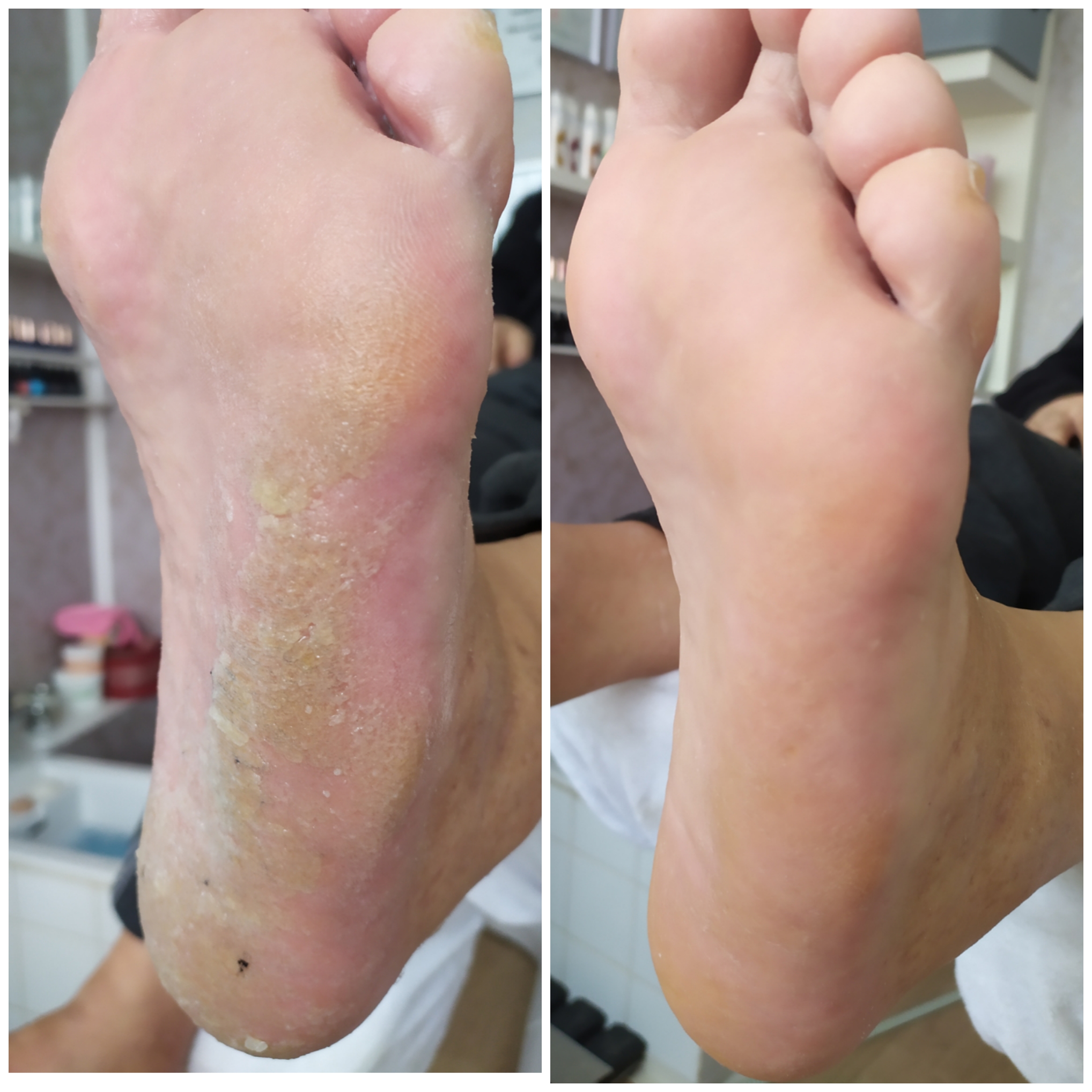 Mobilní Pedikúra Dáša foto 2