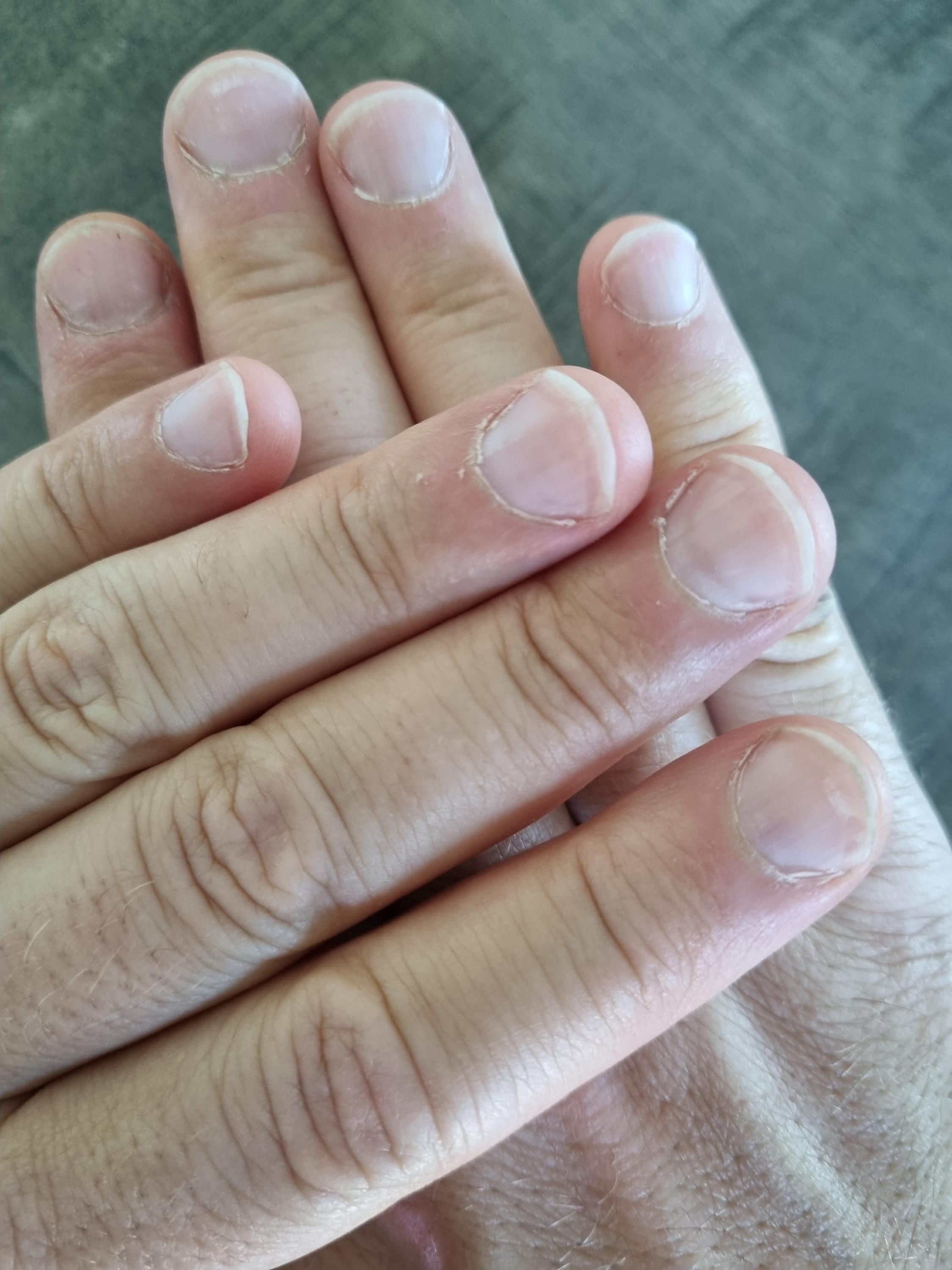 Pedi Markét foto 5