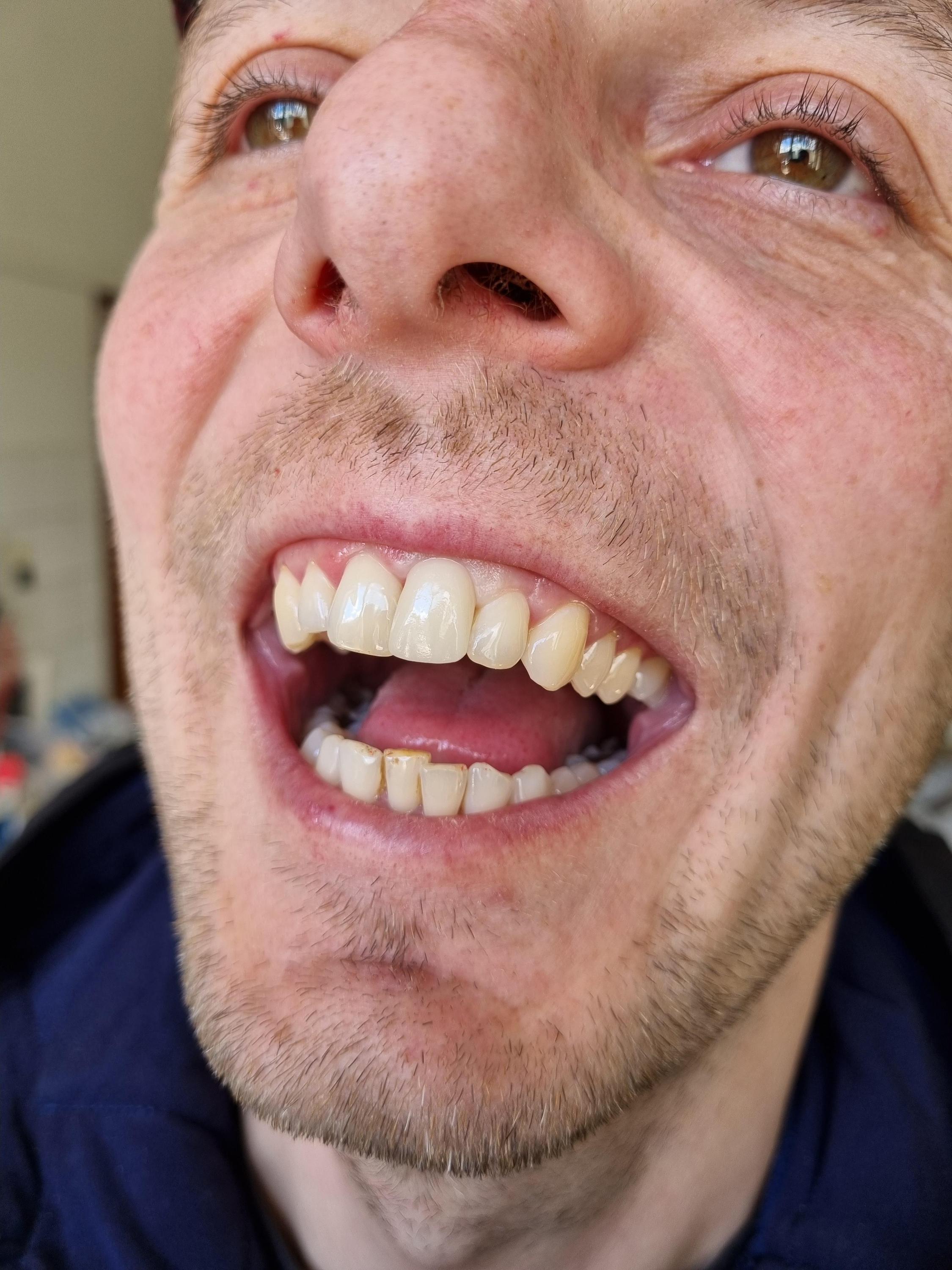 Filip Zachoval foto 2