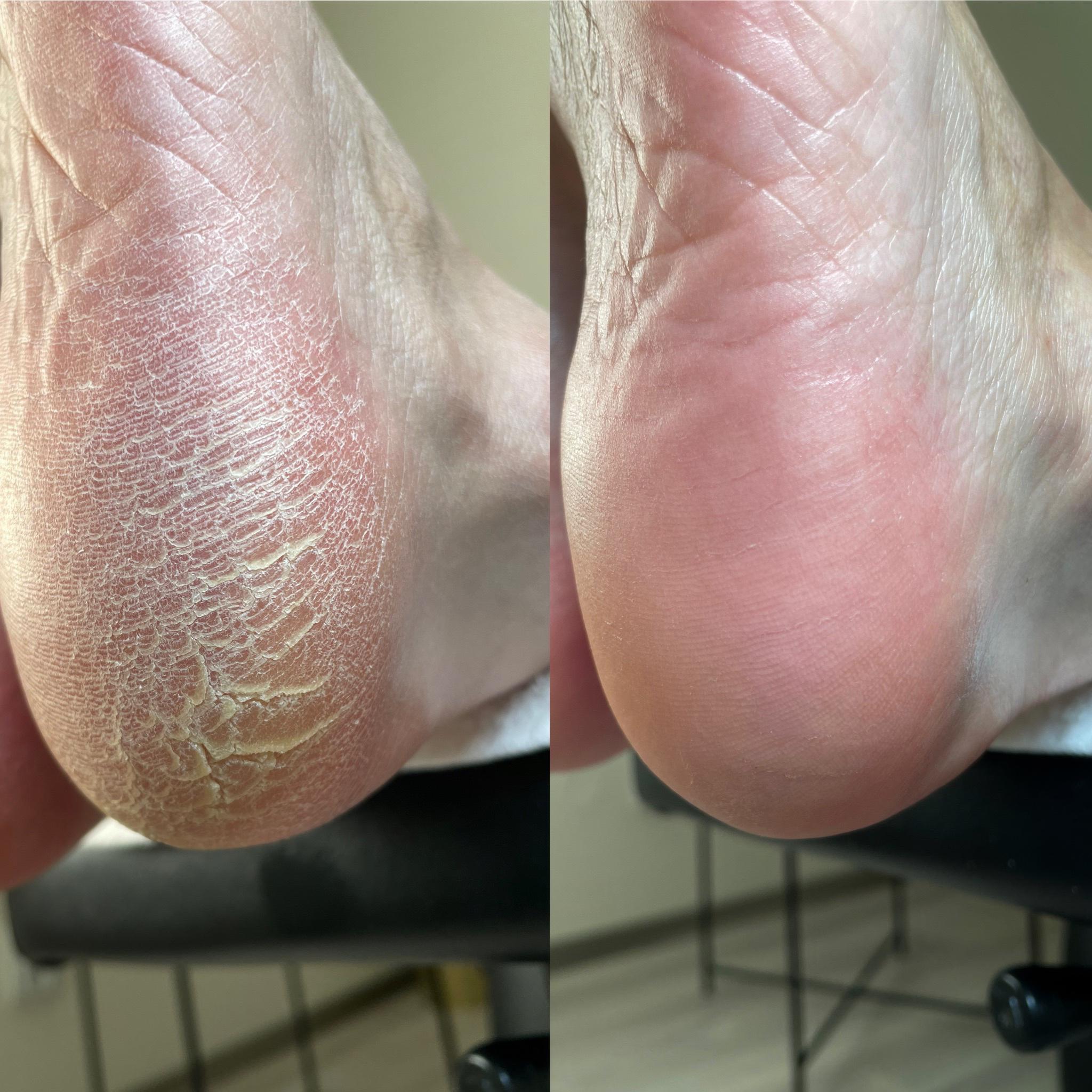 Kateřina Procházková - Pedikúra foto 2