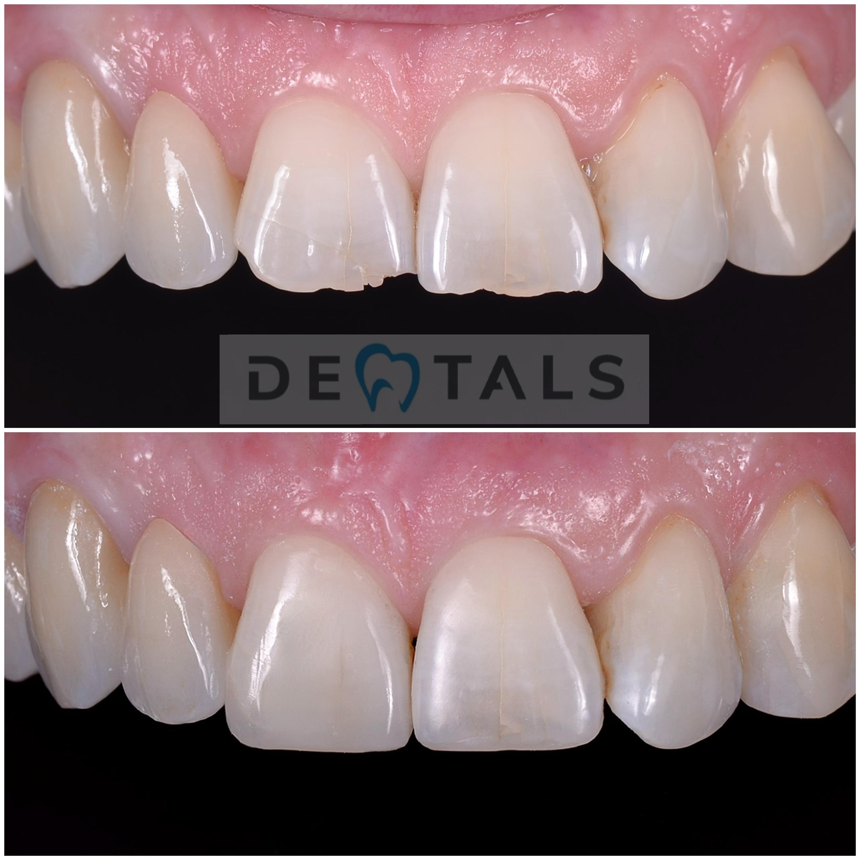 Dentals foto 3