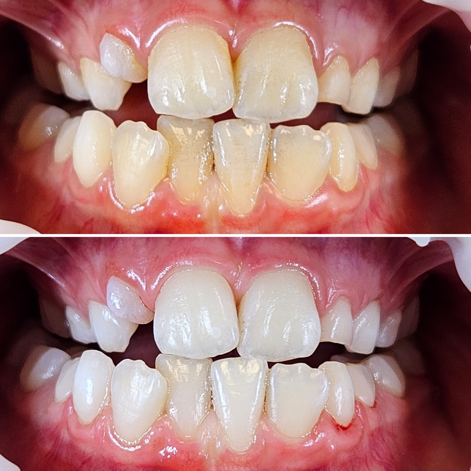 Barbora Svobodová DiS. - dentální hygienistka foto 2