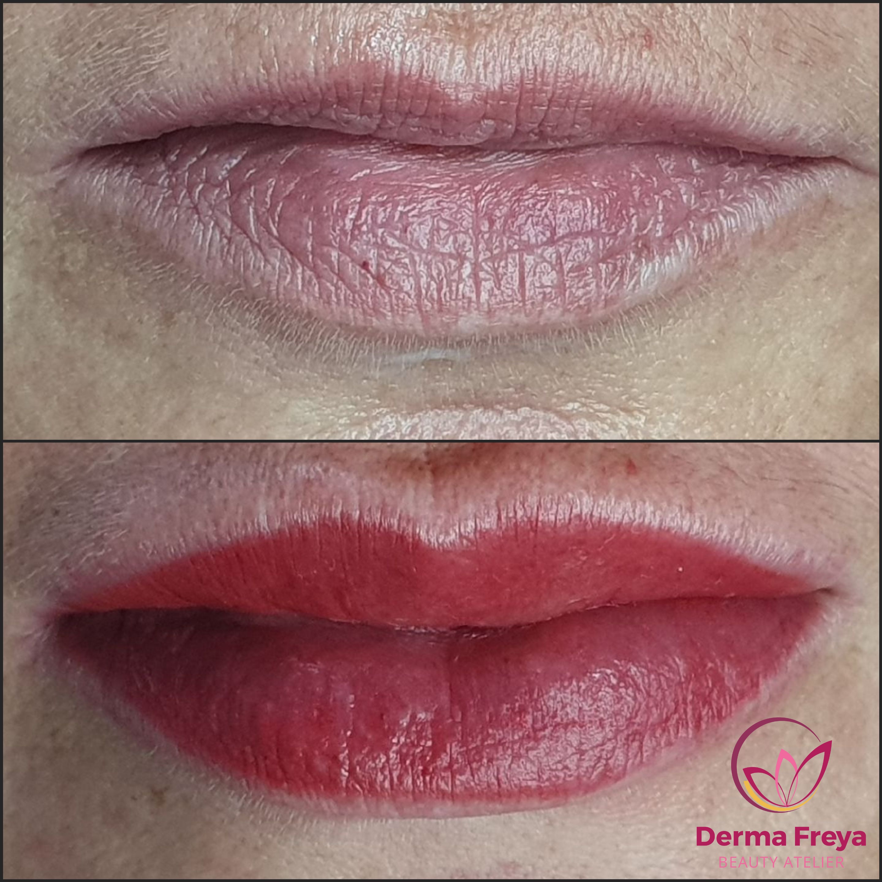 DermaFreya foto 4
