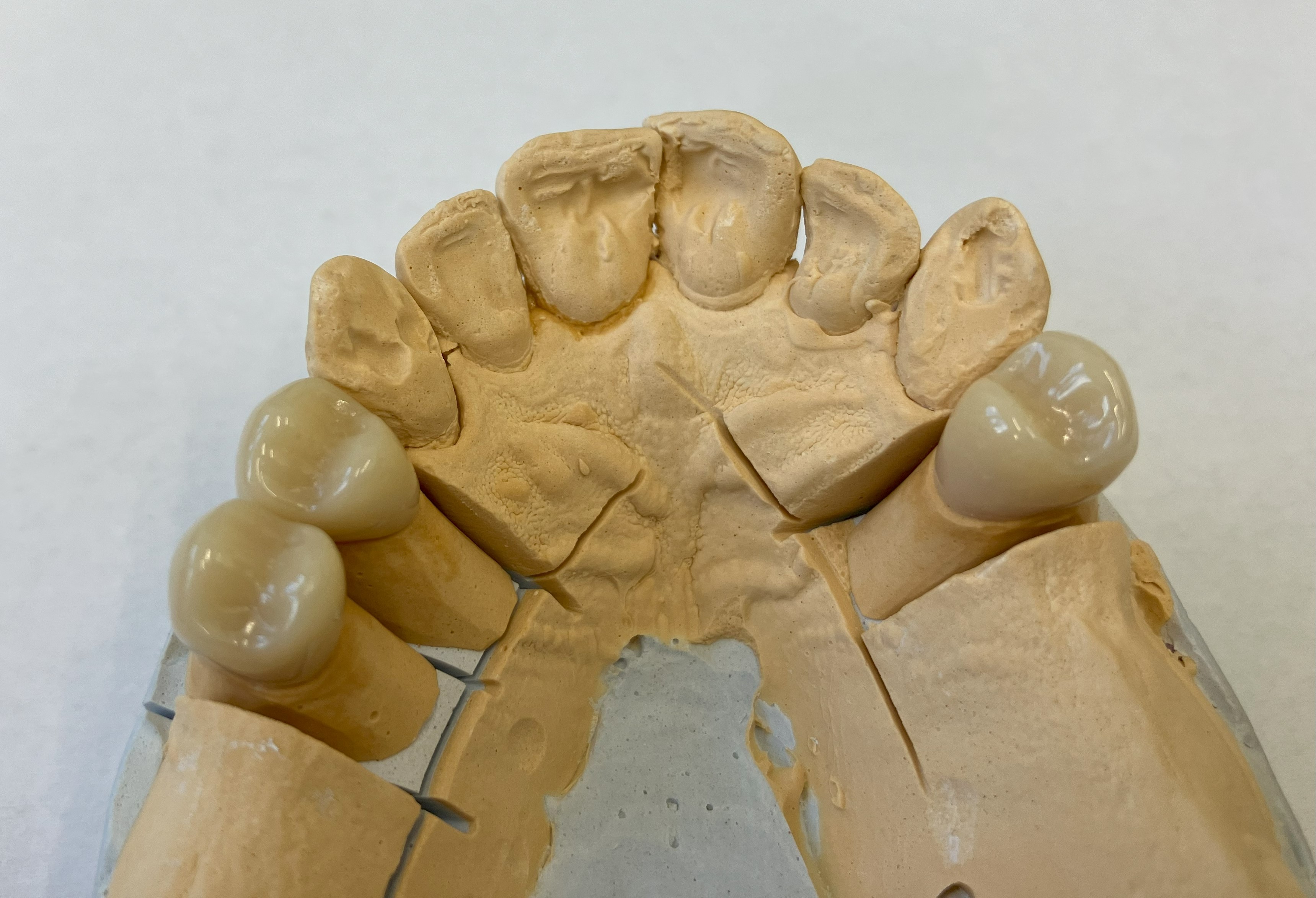 Zubní laboratoř Jiřina Nováková foto 4