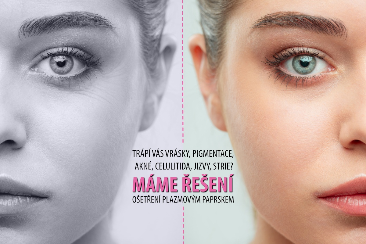 Love Beauty - plasma skin care foto 3