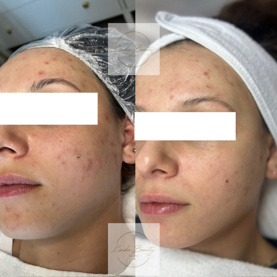 LIN_skintherapist foto 5