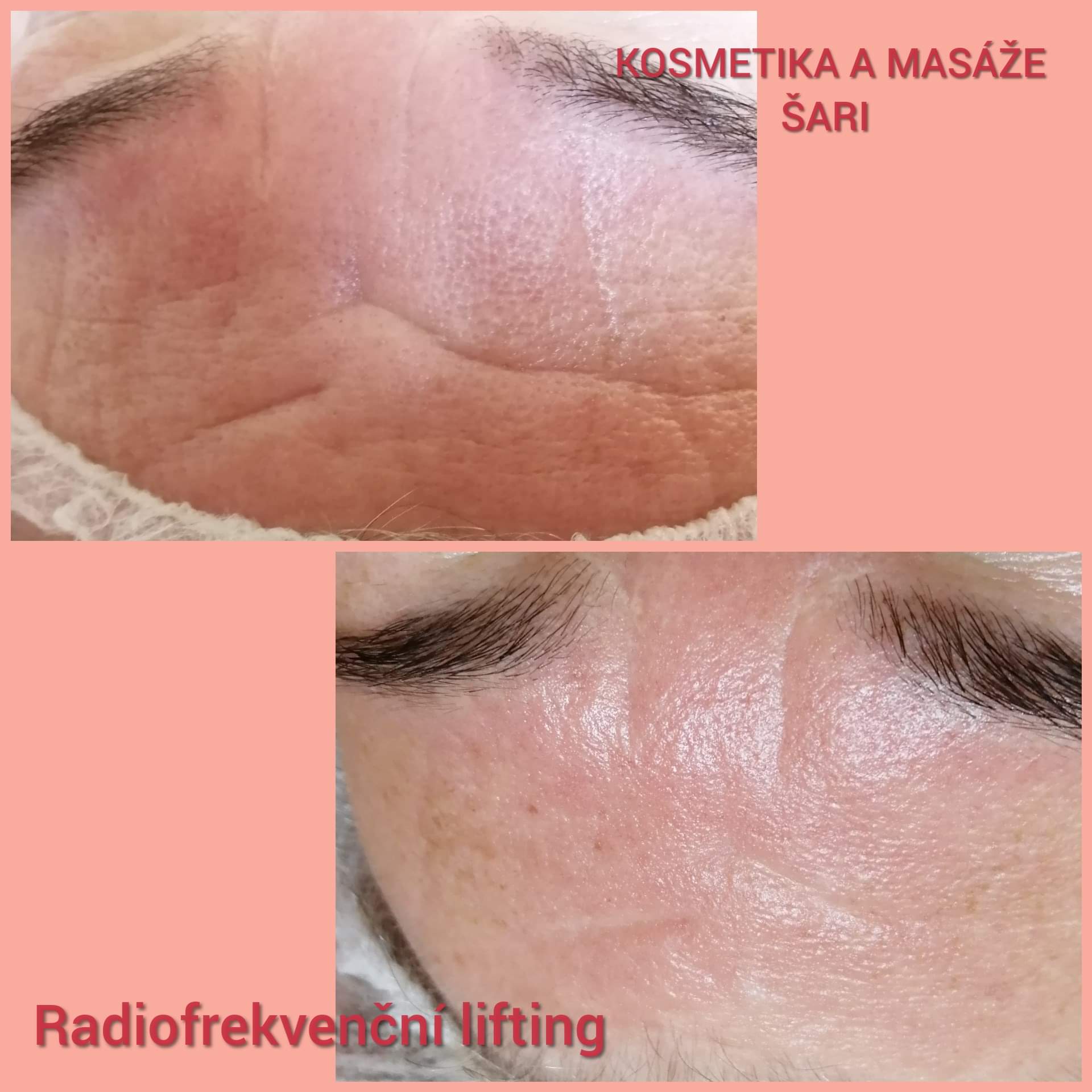 Kosmetika a masáže Šari foto 6