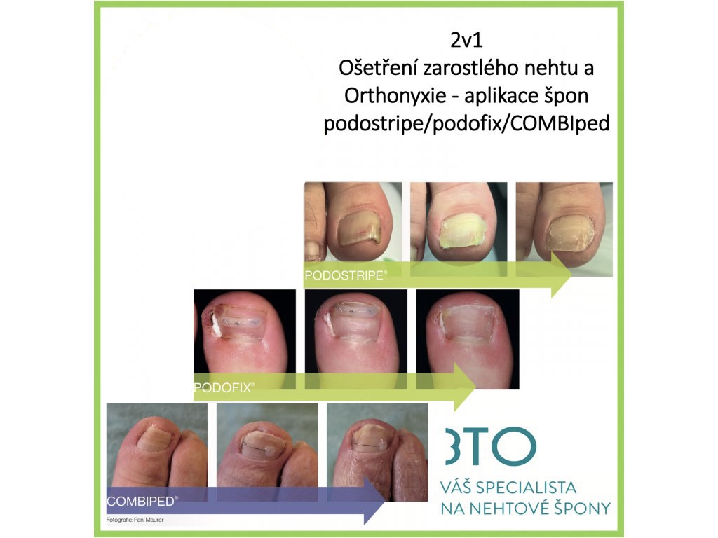 Bc. Veronika Páleníková Šponarová foto 2