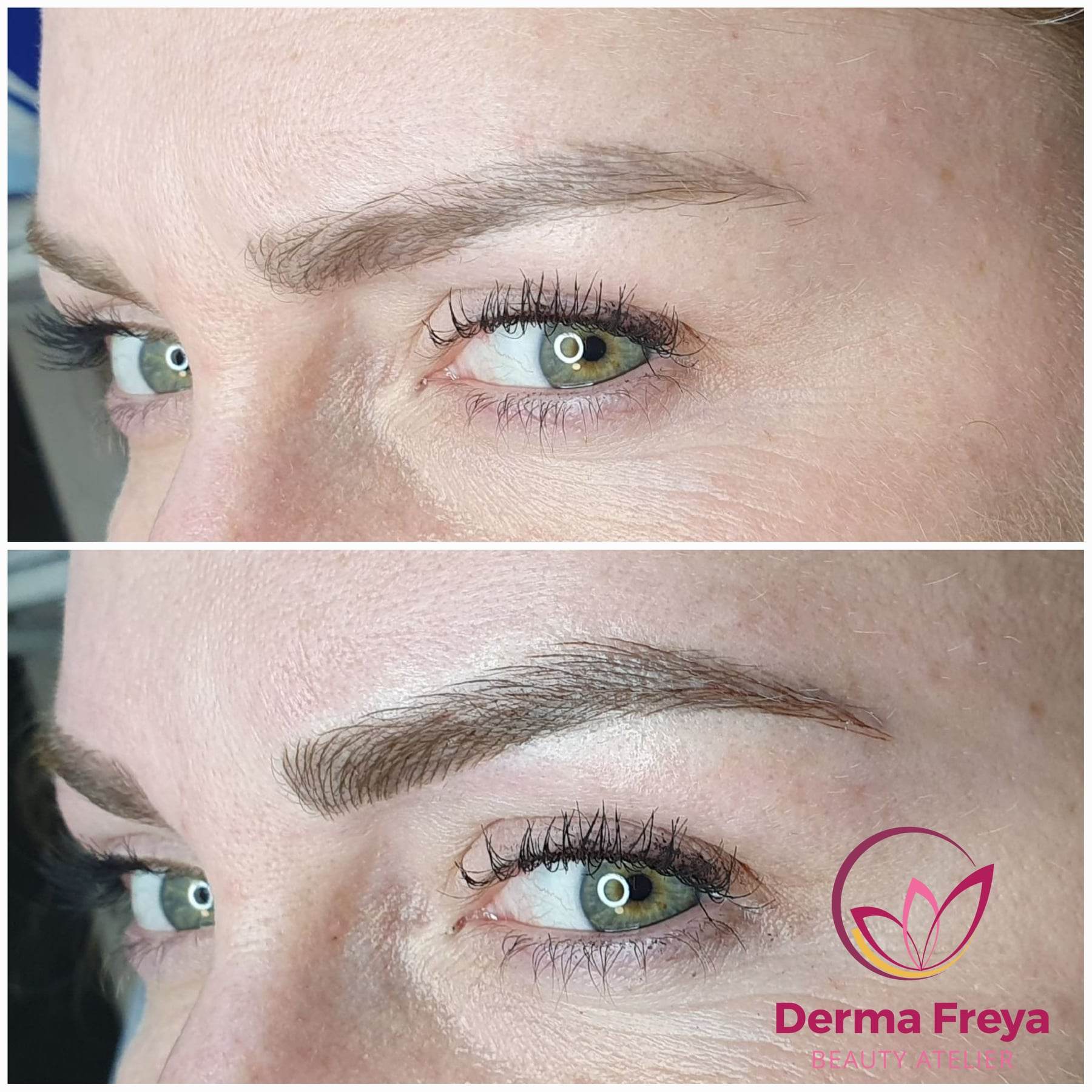 DermaFreya foto 3