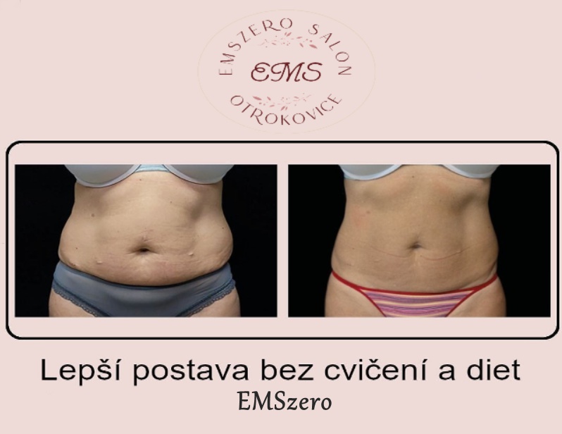EMSzero Salon foto 4