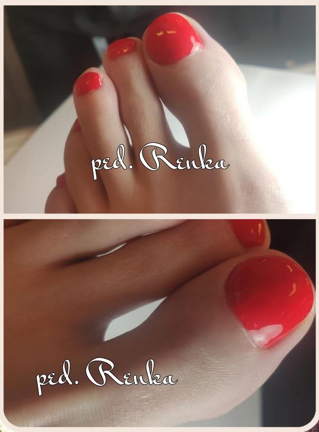 Přístrojová pedikúra Renáta Kaňoková foto 4