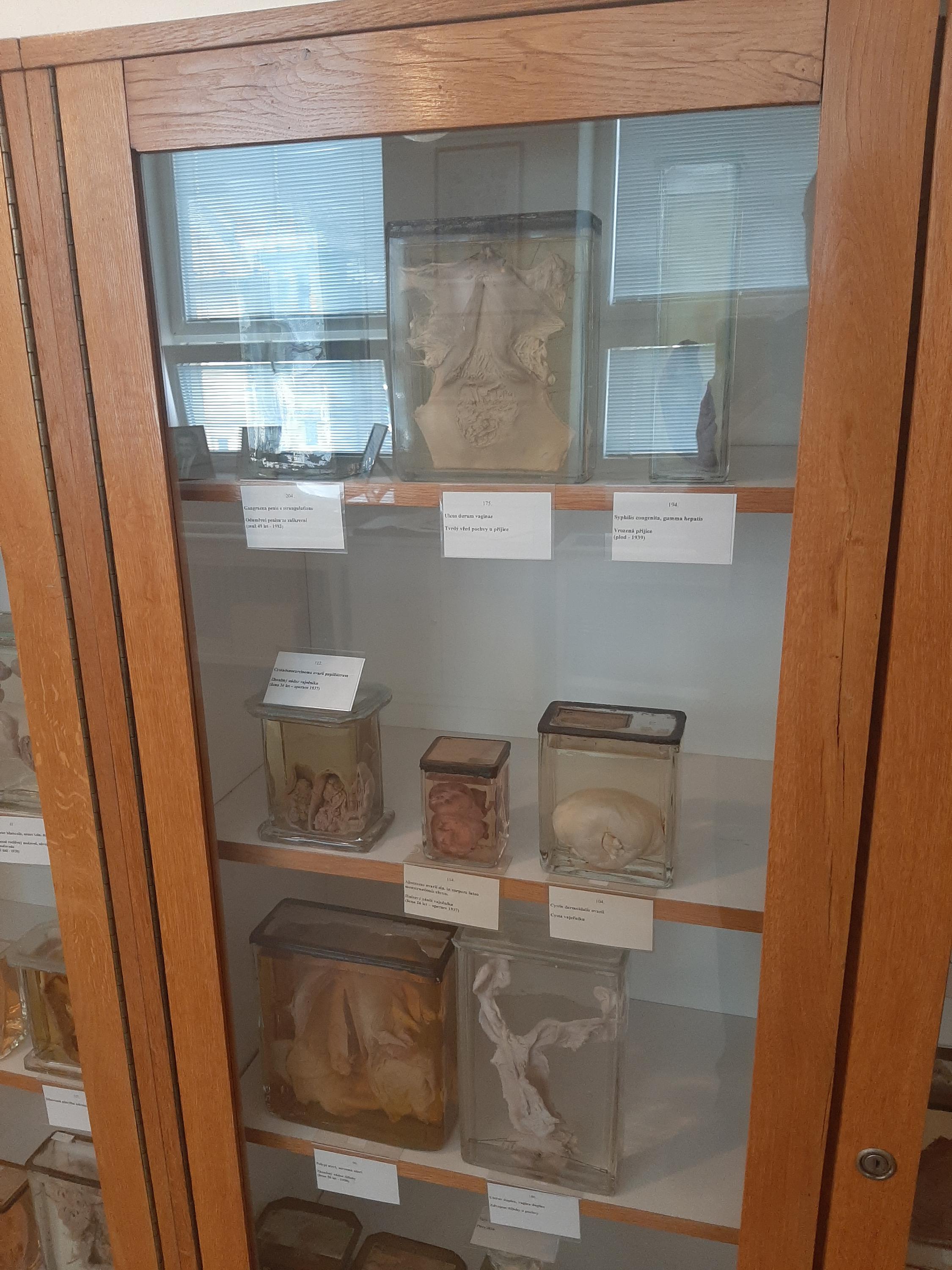 Muzeum patologie - Moravskoslezská nemocnice Opava foto 6