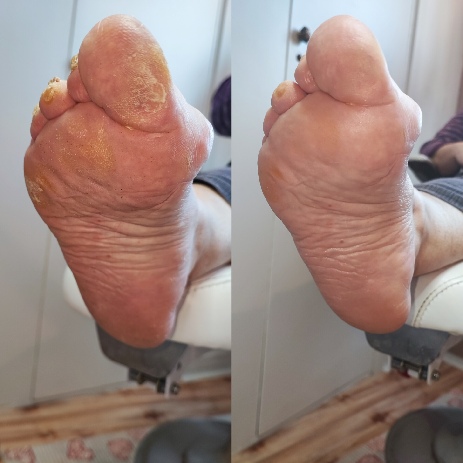 Tereza Dusilová - pedikúra foto 2