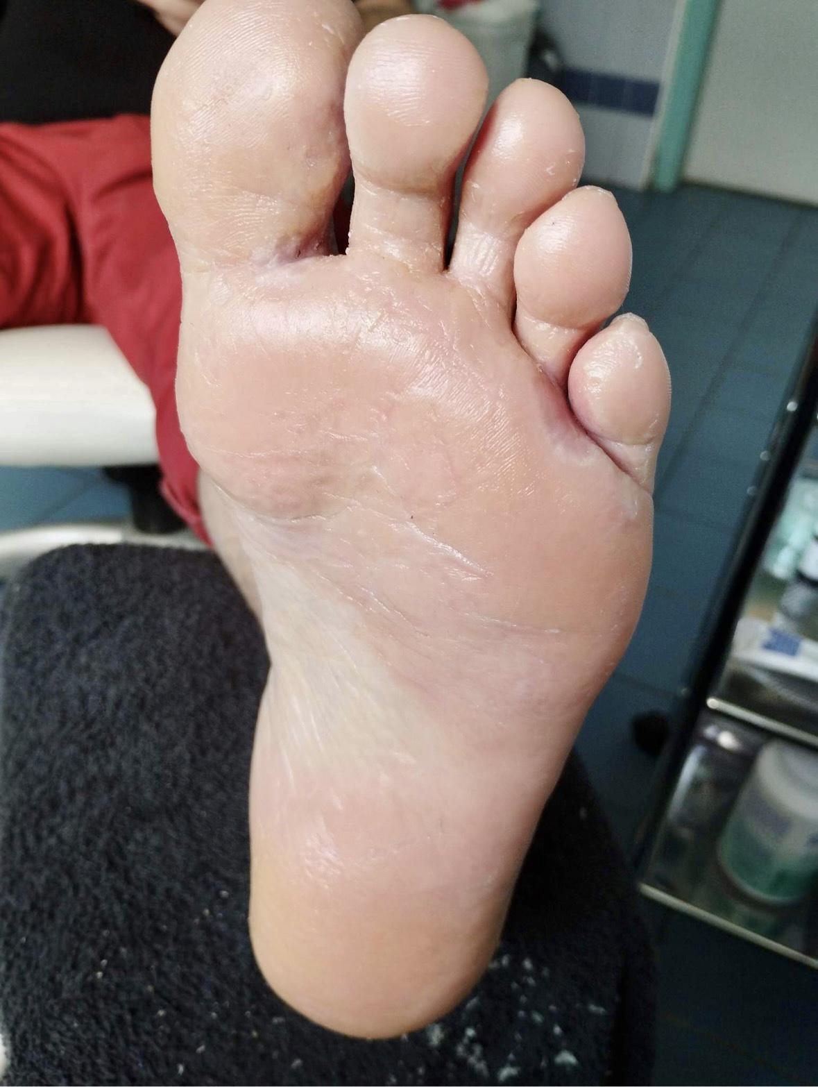 Pedikúra Martina Hořčicová foto 3