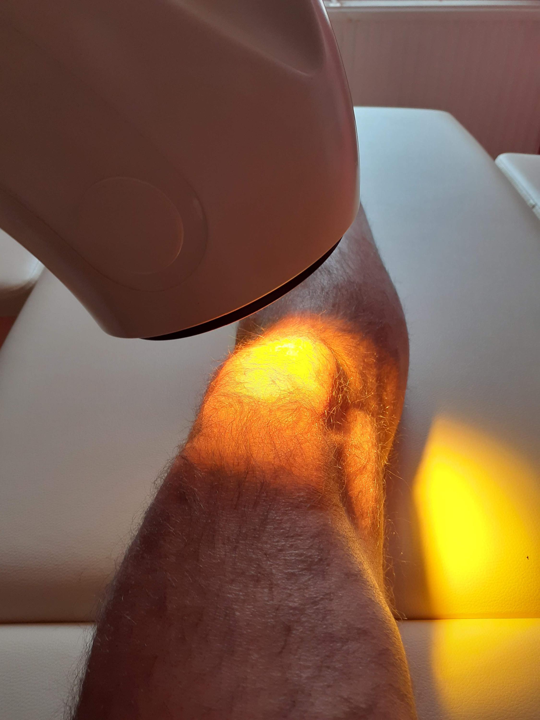 Bioptron světelná terapie, masáže foto 3