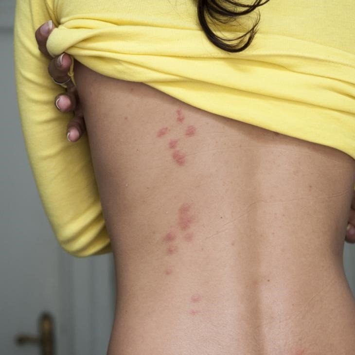 DERONA deratizace, s.r.o. foto 2