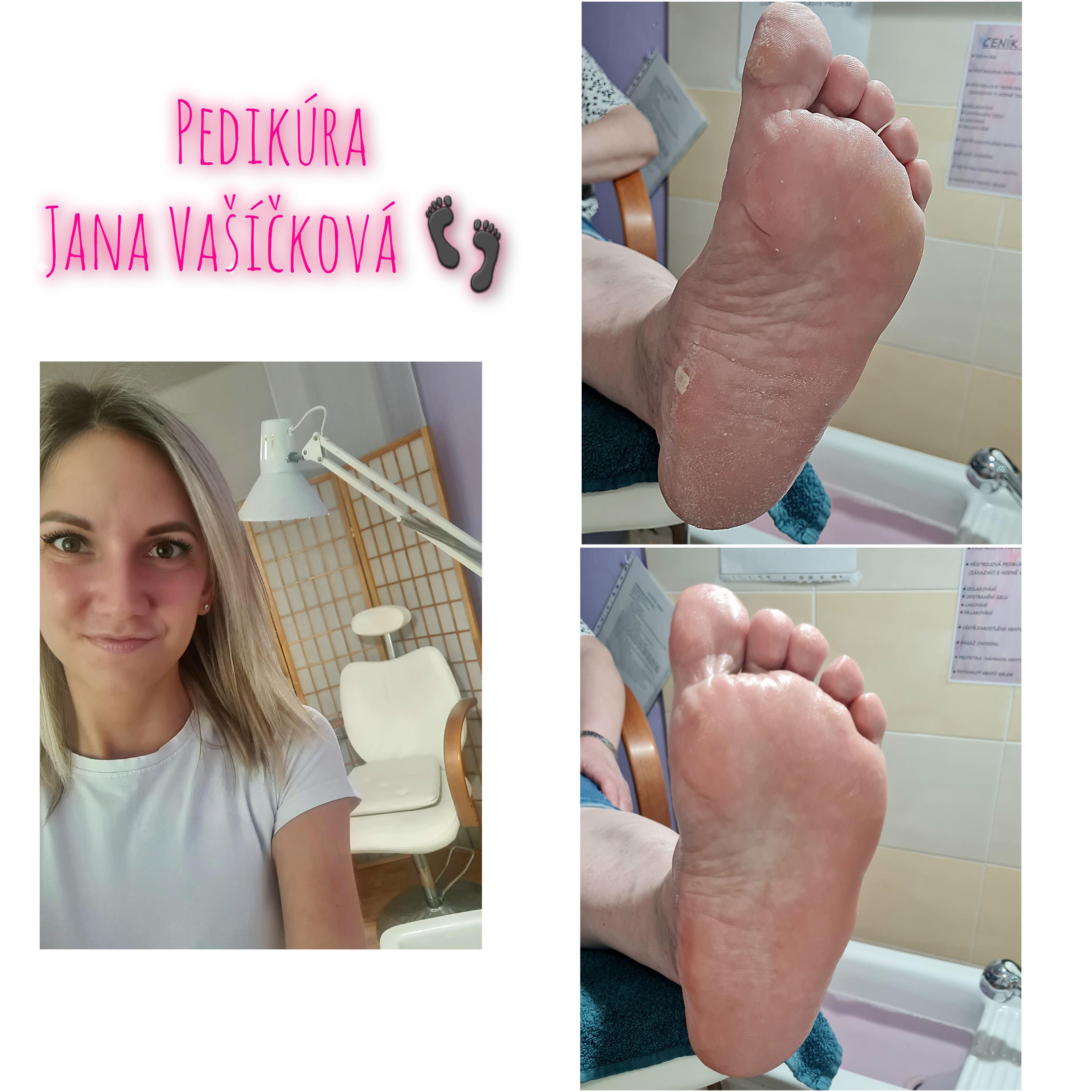 Pedikúra Jana Vašíčková foto 4