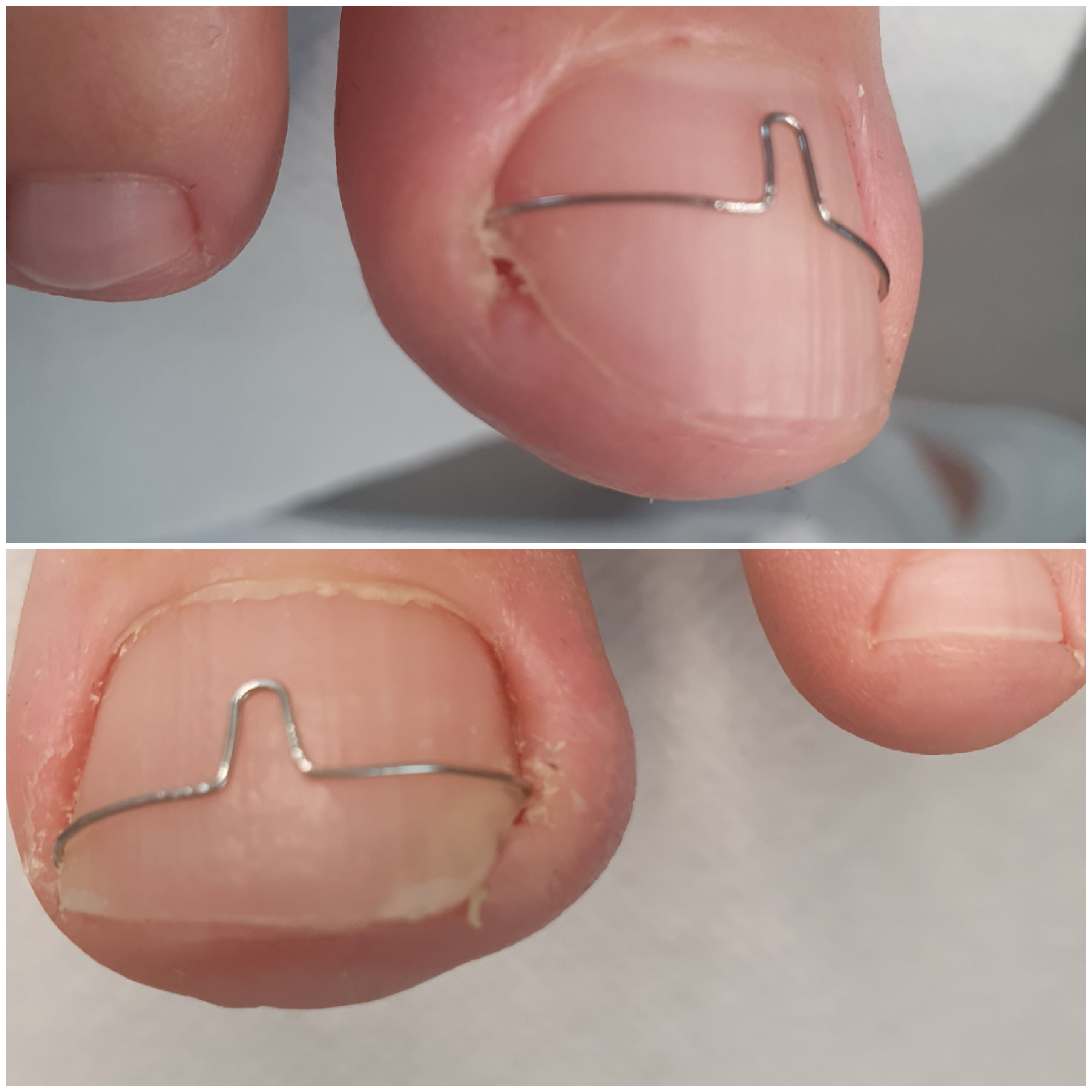 Pedikúra - podologie Olina Procházková foto 3