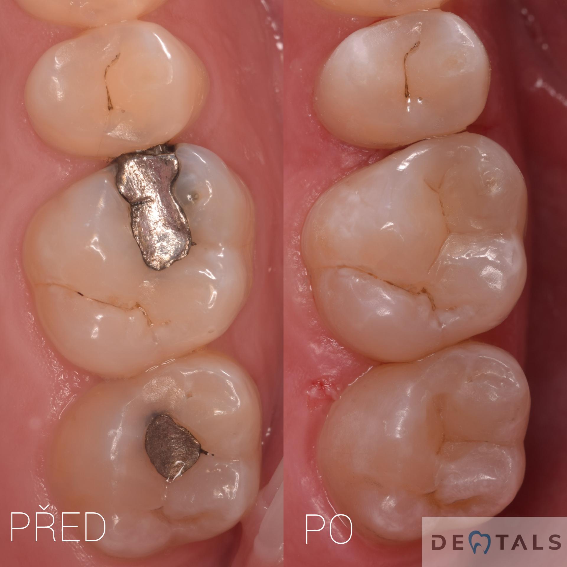 Dentals foto 5