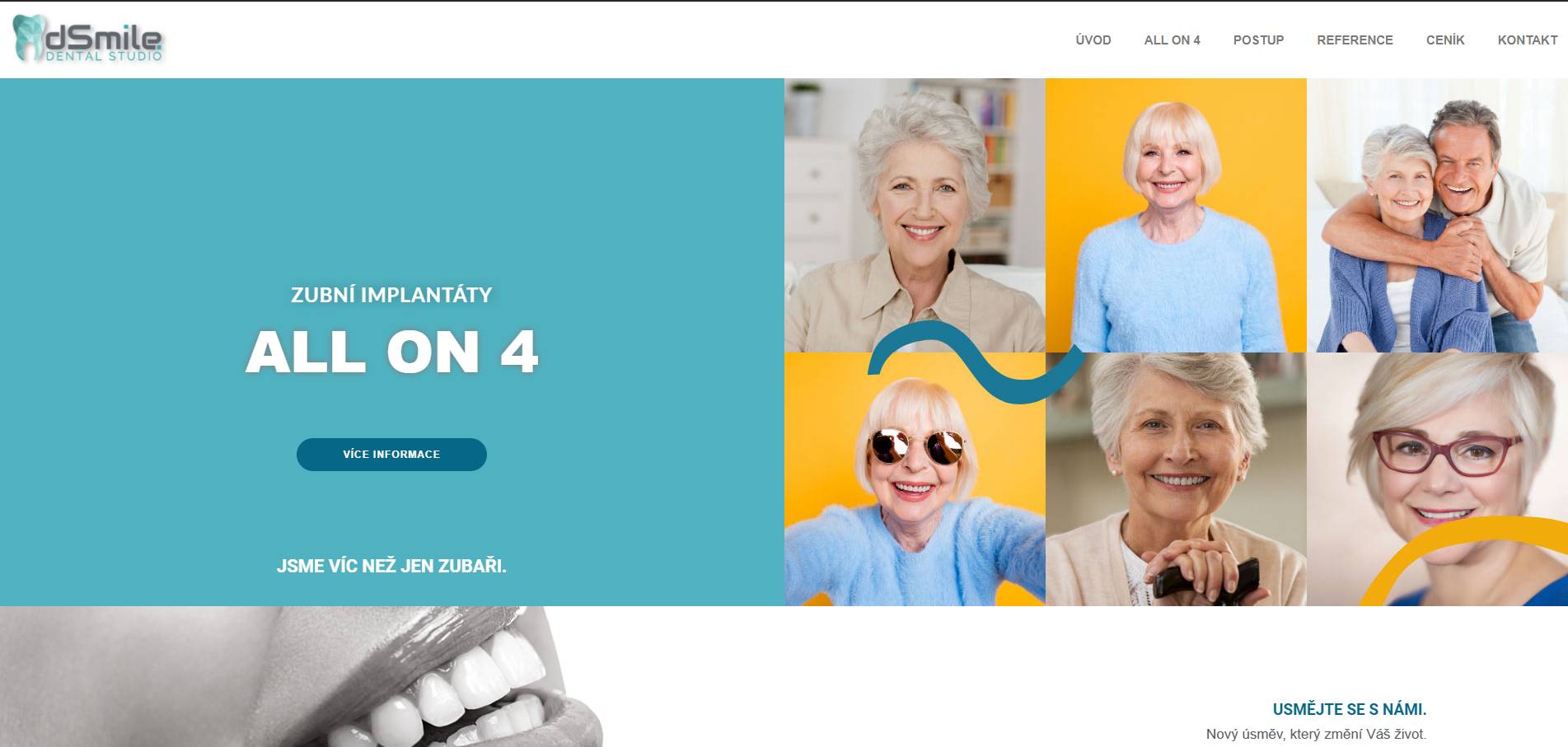 All-on-4-implantaty.cz - dSmile foto 2