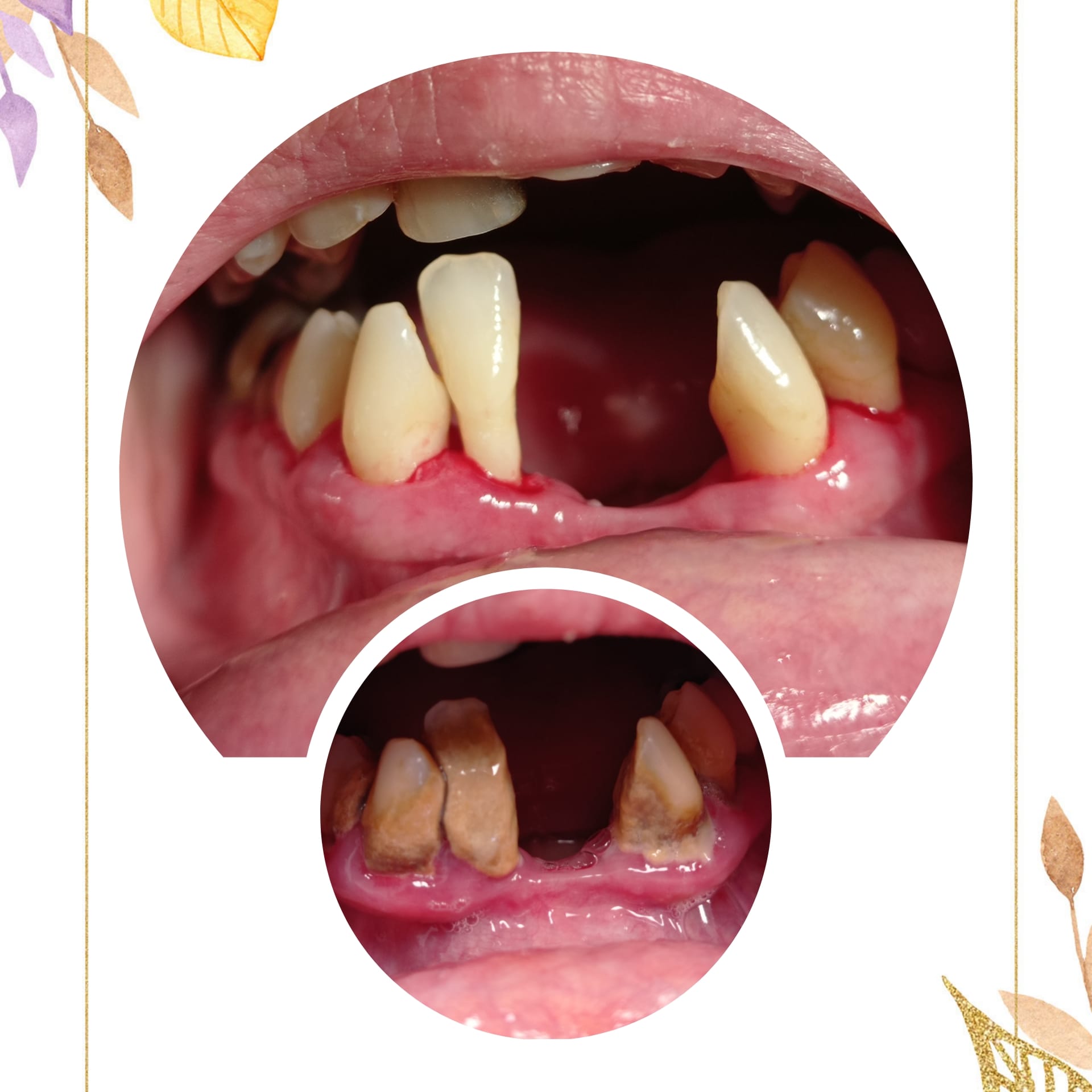 Iveta Stará, DiS. Profesionální dentální hygiena foto 4