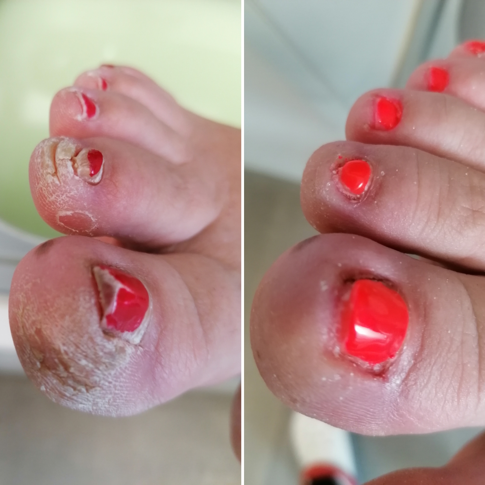 Pedikúra NABOSO foto 6