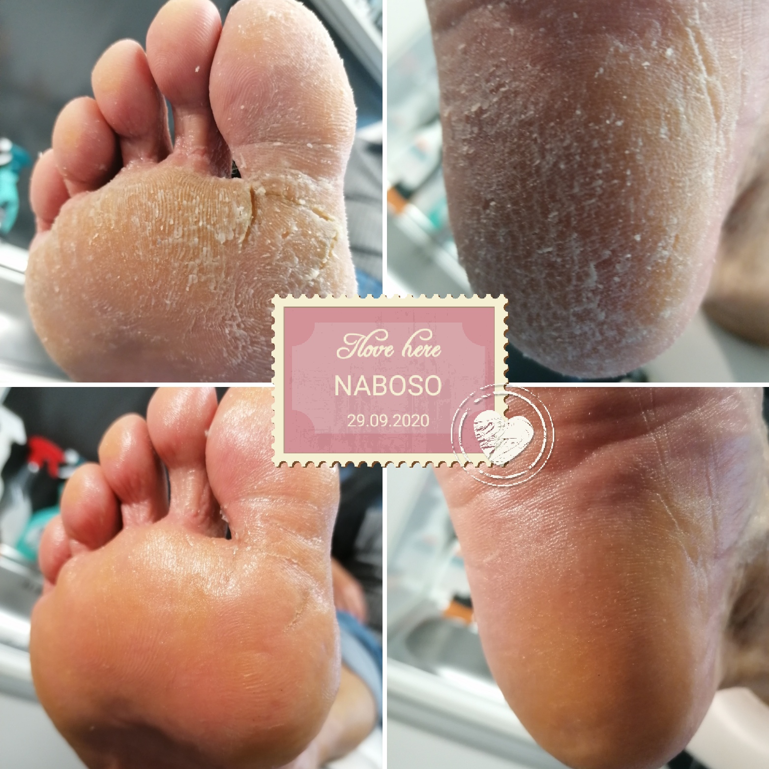 Pedikúra NABOSO foto 5