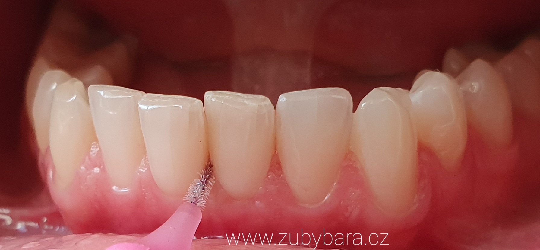 Barbora Svobodová DiS. - dentální hygienistka foto 4