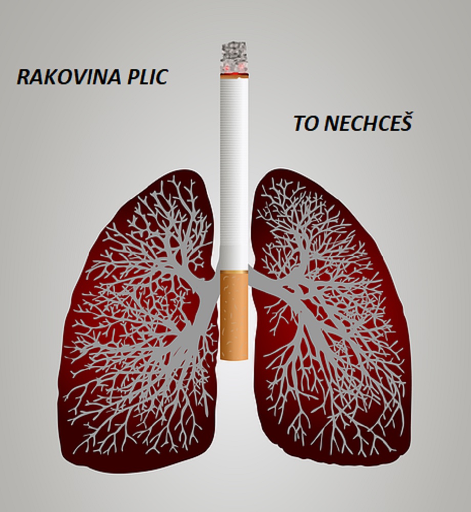 Milan Báchor - Vše začíná v hlavě foto 6