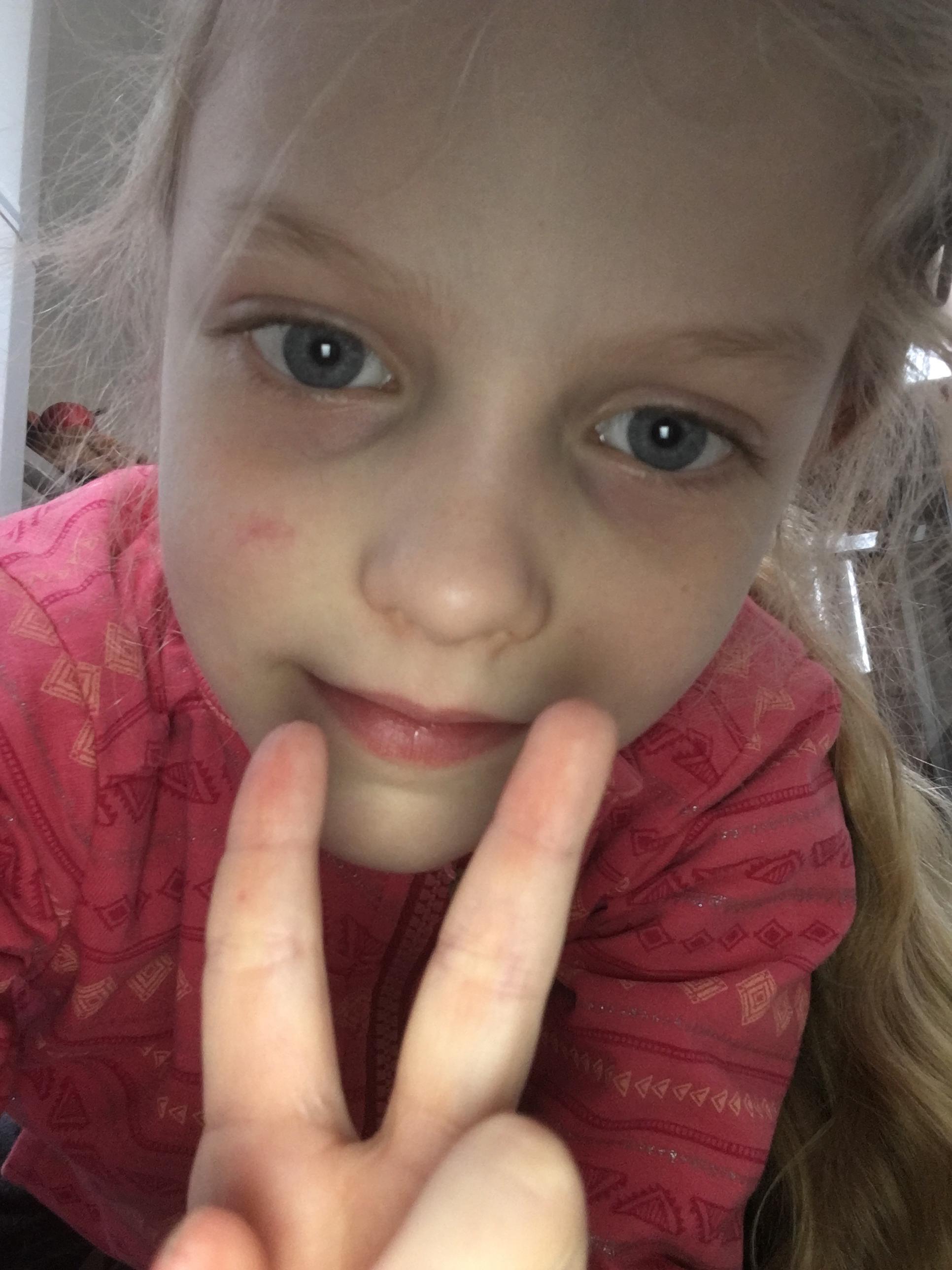 ZŠ, ZUŠ a MŠ Frýdlant - Purkyňova foto 4