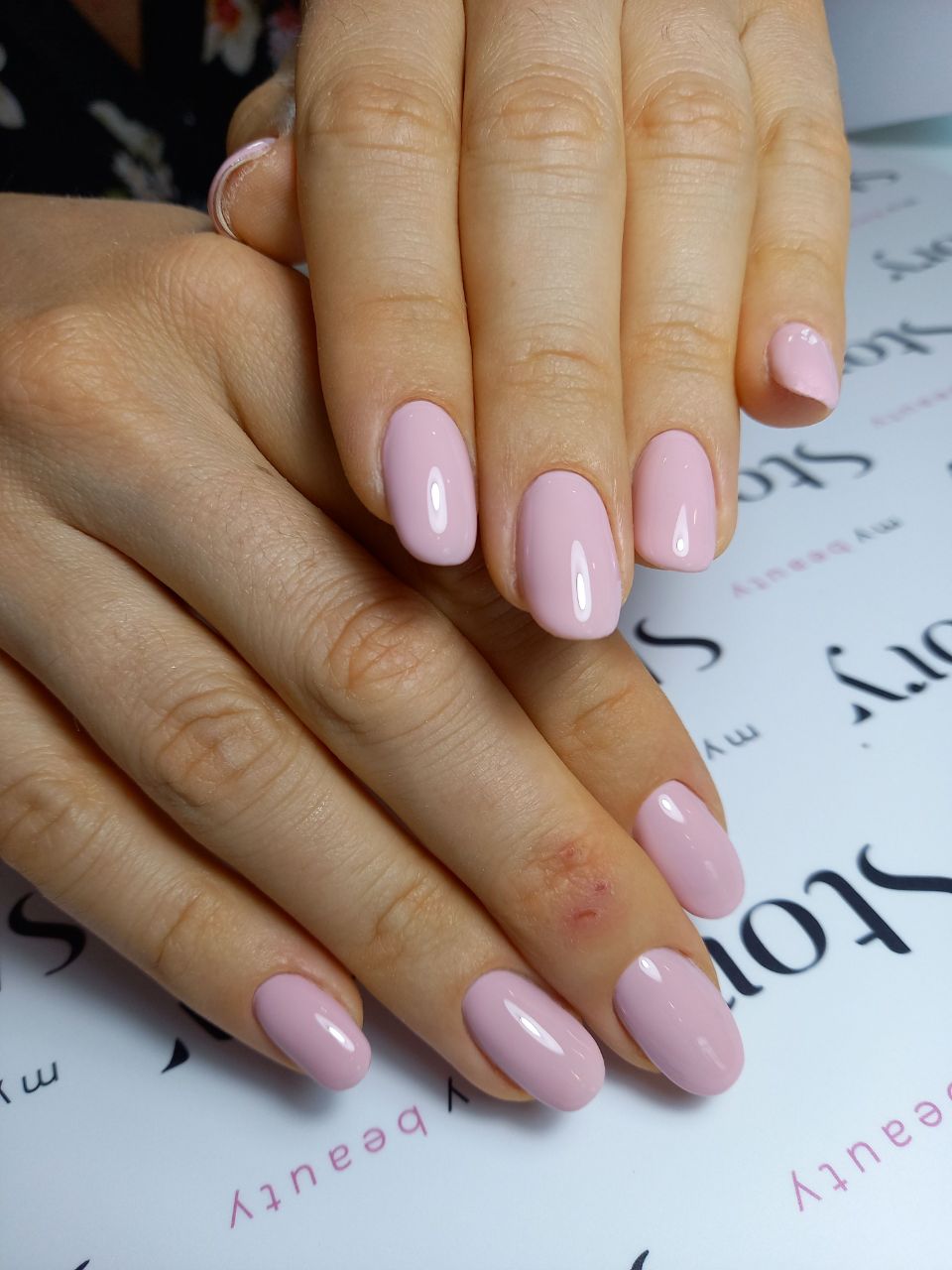 my beauty Story foto 5